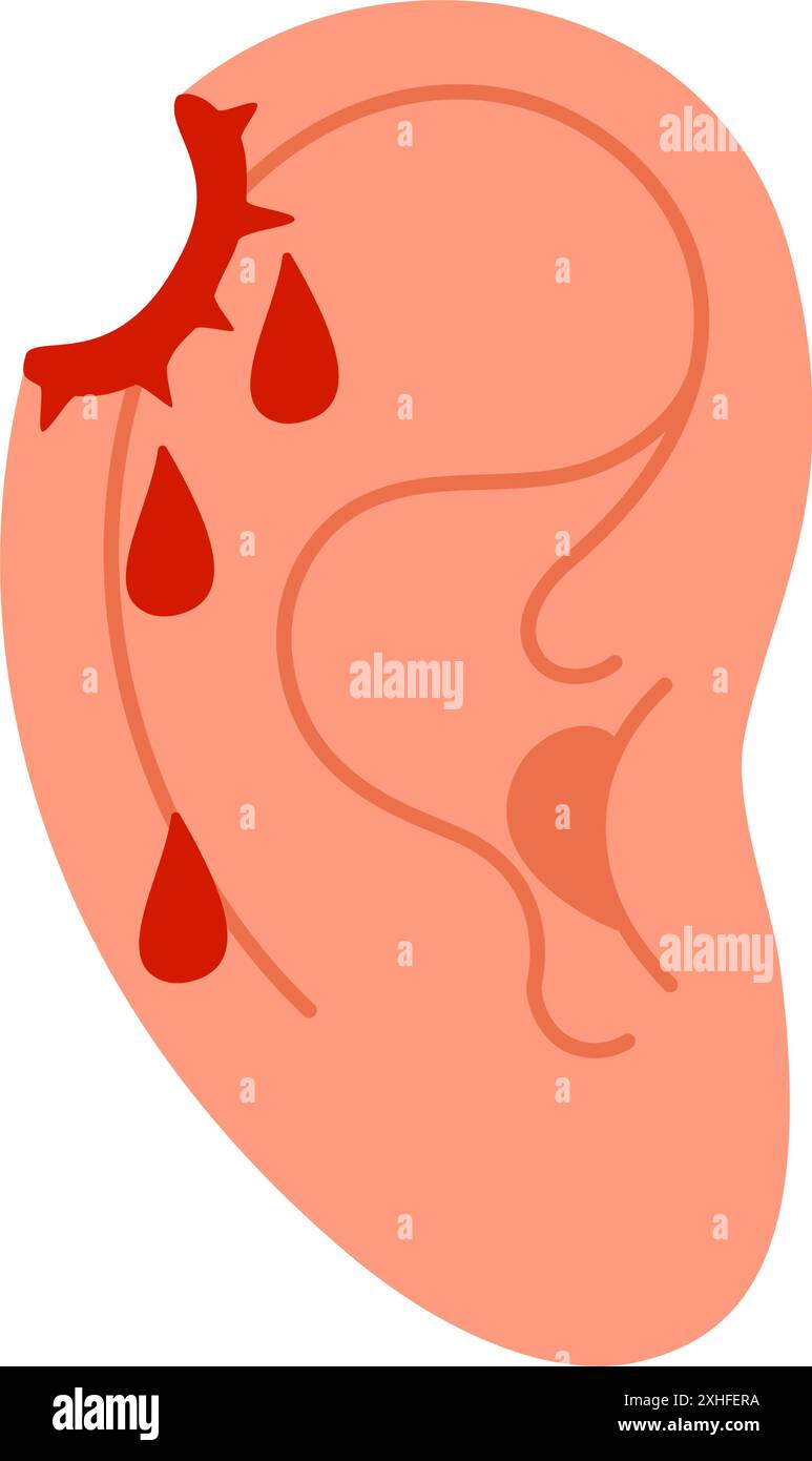 Verwundetes Ohr. Rundloch. Verletztes menschliches Ohr mit Bluttropfen. Ein Gefühl von Verletzungen oder Schmerzen im Ohr. Abgewickelte Vektorillustration Stock Vektor