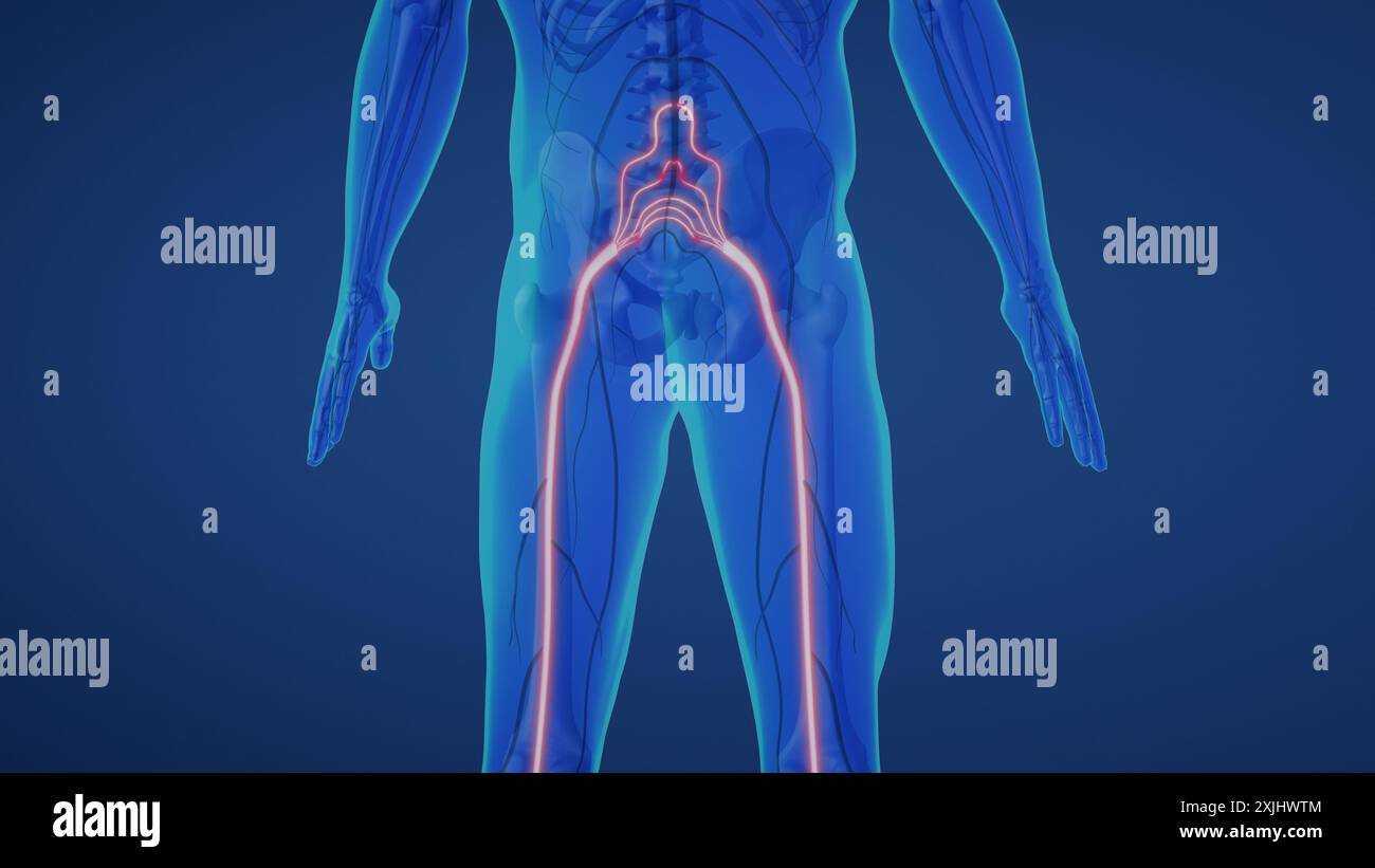 Nervenschmerzen des Ischias im Unterkörper Stockfoto