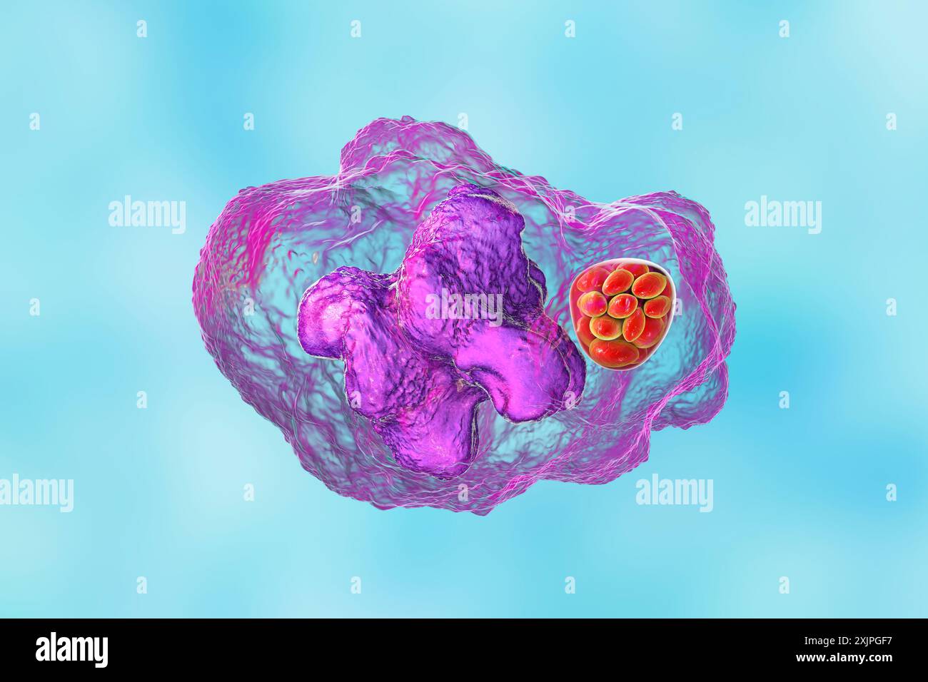 Abbildung von Ehrlichia-Bakterien-Morula in Makrophagen, assoziiert mit Ehrlichiose, einer durch Zecken übertragenen Infektionskrankheit. Stockfoto