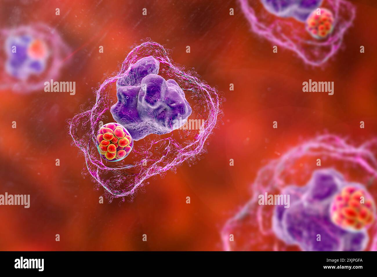 Abbildung von Ehrlichia-Bakterien-Morula in Makrophagen, assoziiert mit Ehrlichiose, einer durch Zecken übertragenen Infektionskrankheit. Stockfoto