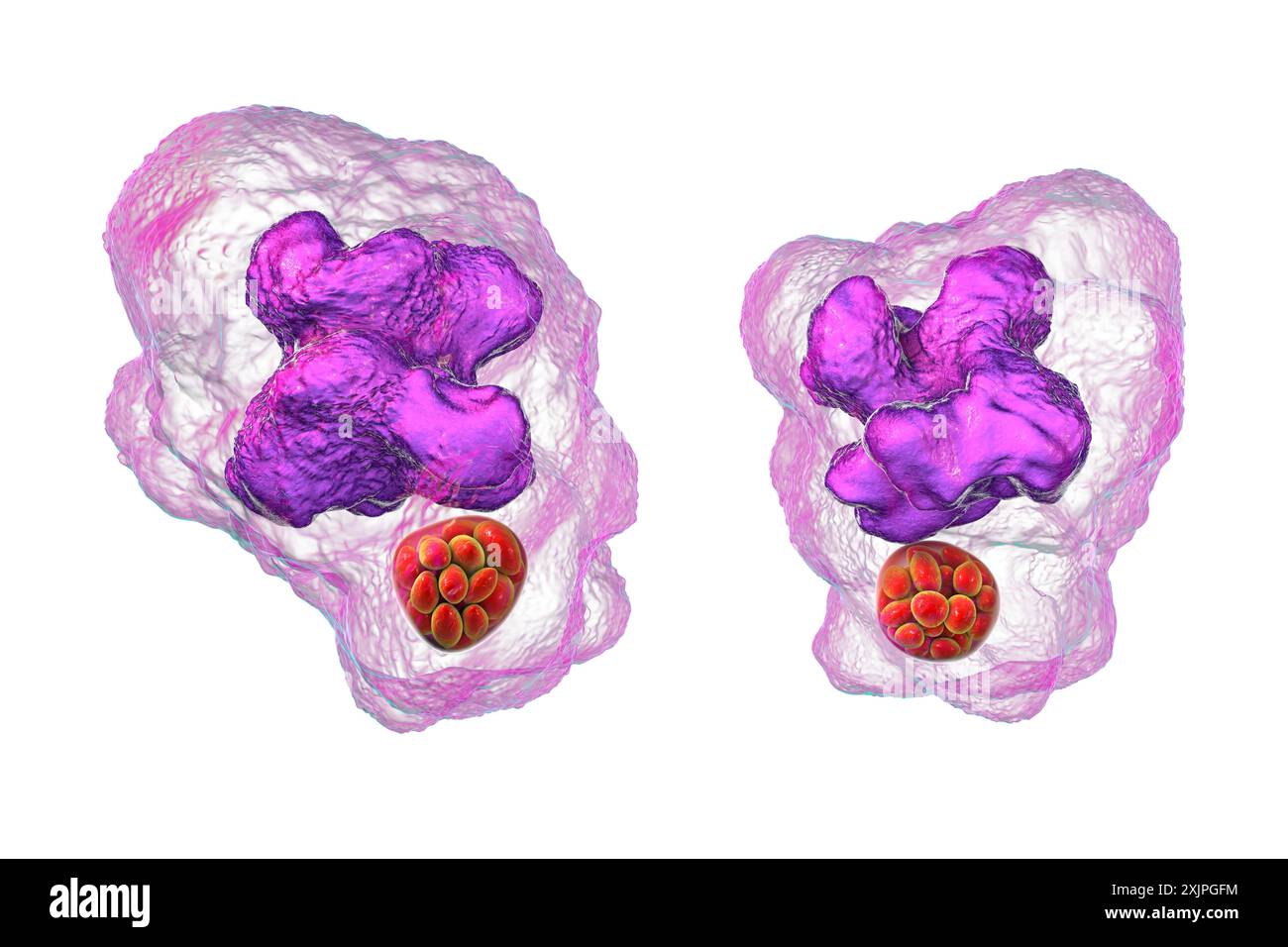 Abbildung von Ehrlichia-Bakterien-Morula in Makrophagen, assoziiert mit Ehrlichiose, einer durch Zecken übertragenen Infektionskrankheit. Stockfoto