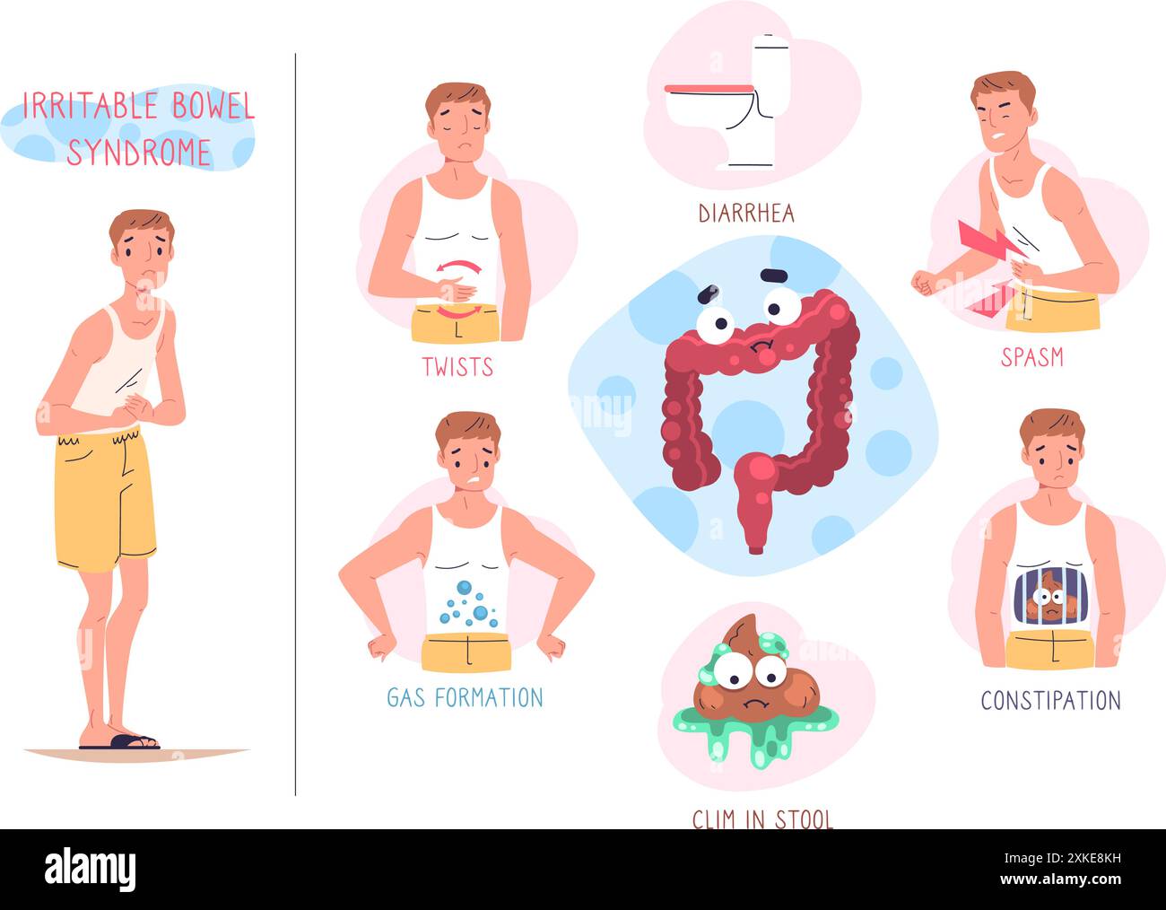 RDS-Symptome. Reizdarmsyndrom Infografik, Magen Verdauungskrankheit Symptom Durchfall Obstipation Infektion chronische Darmerkrankung, Gesundheit Klasse Vektor Illustration Autoren Grafiken Stock Vektor