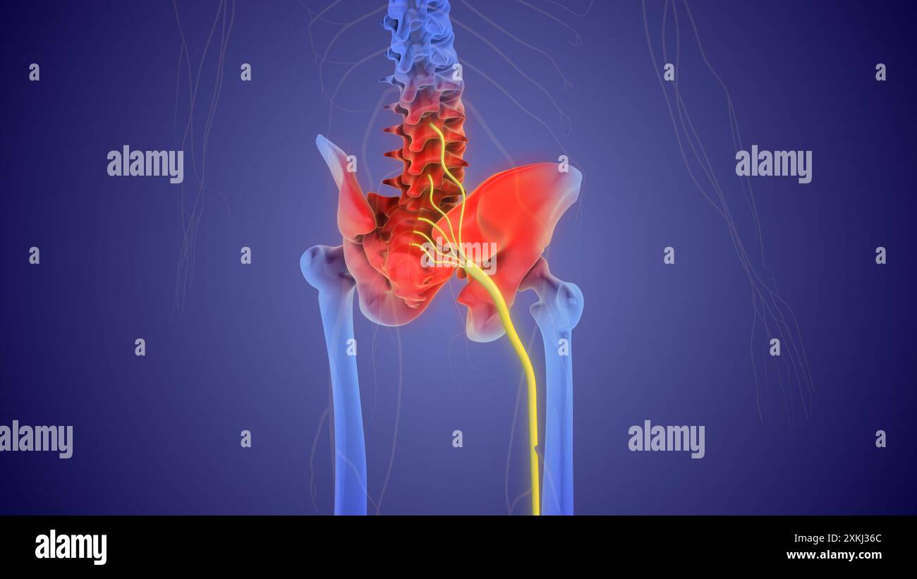 Das medizinische Konzept des Ischiasnervenschmerzes Stockfoto