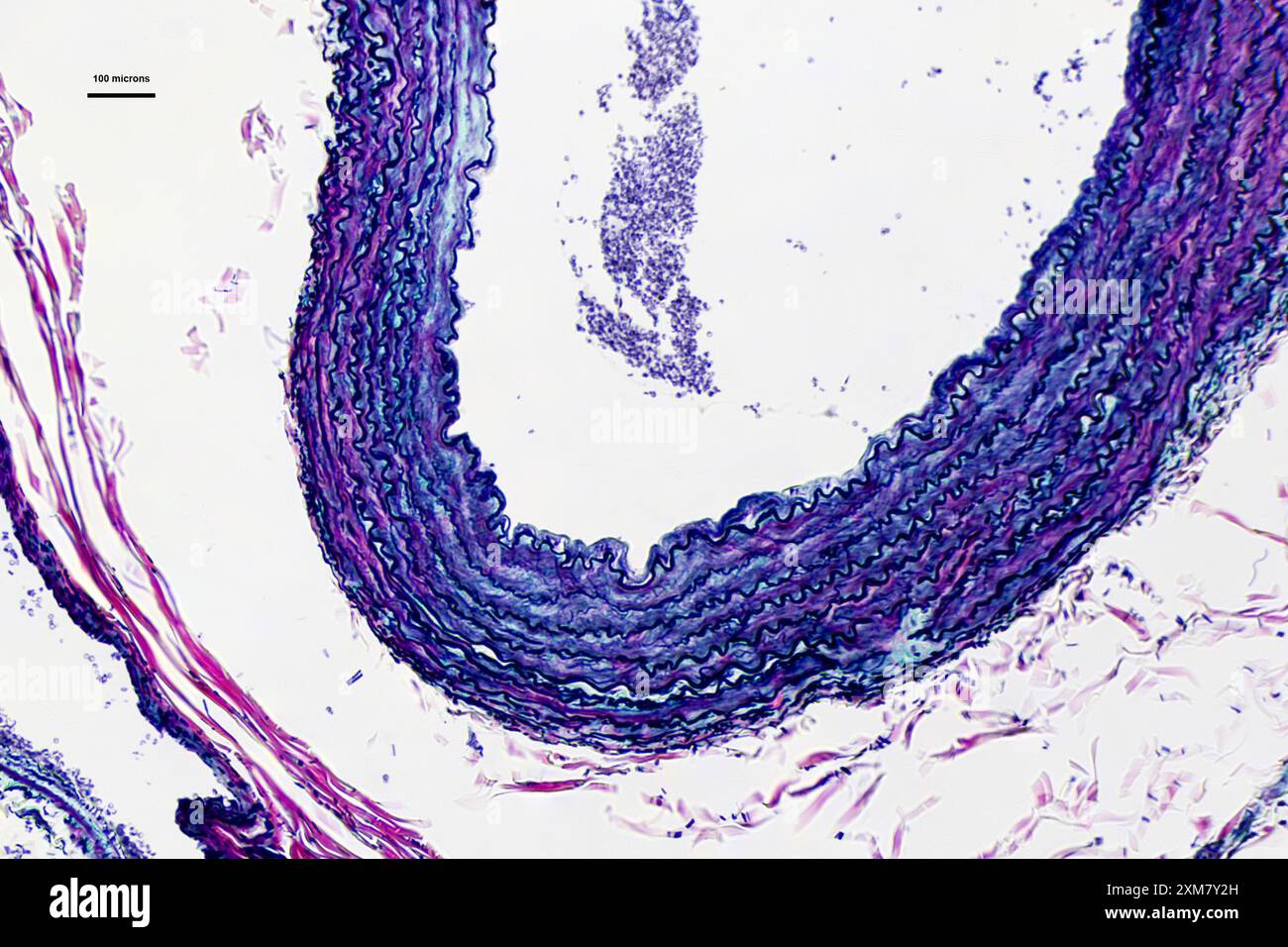 Arterien im Dünnschnitt unter einem Lichtmikroskop mal 40 Vergrößerung Stockfoto