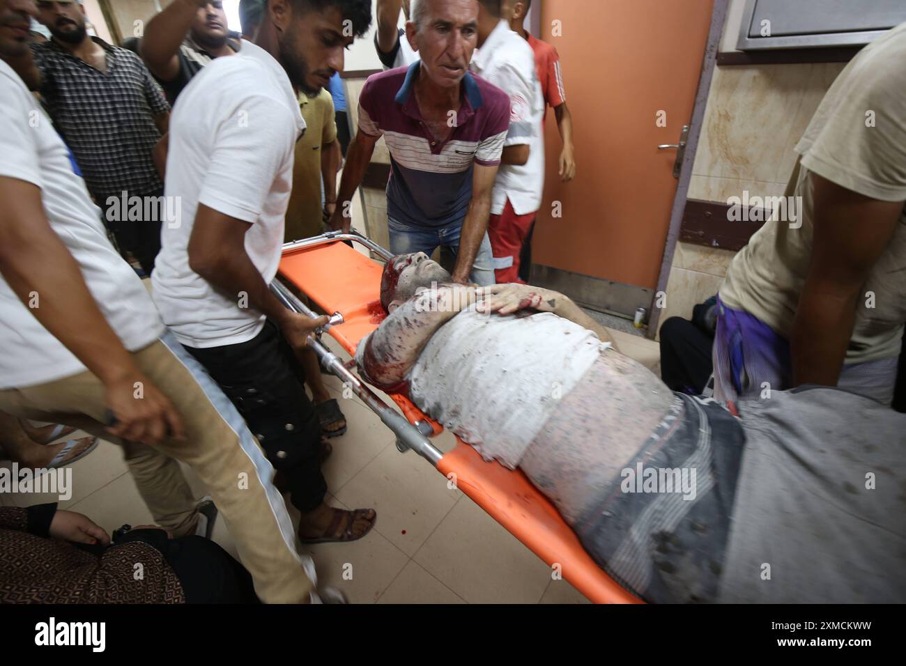 Verletzte Palästinenser werden in das Al-Aqsa Märtyrerkrankenhaus gebracht, in der Folge eines israelischen Streiks während des israelischen Krieges auf Gaza, in Deir Al-Balah werden verletzte Palästinenser in das Al-Aqsa Märtyrerkrankenhaus gebracht, nach einem israelischen Streik während des israelischen Krieges auf Gaza, in Deir Al-Balah. im zentralen Gazastreifen am 27. Juli 2024. 31 Palästinenser wurden bei der Beschuss des Feldlazaretts in der Haditha-Schule getötet und Dutzende verletzt. Foto: Ali Hamad apaimages Dair El-Balah Gazastreifen palästinensisches Gebiet 270724 Dair EL Balah AH 0013 Copyright: XapaimagesxAlixHamadxapaimagesx Stockfoto