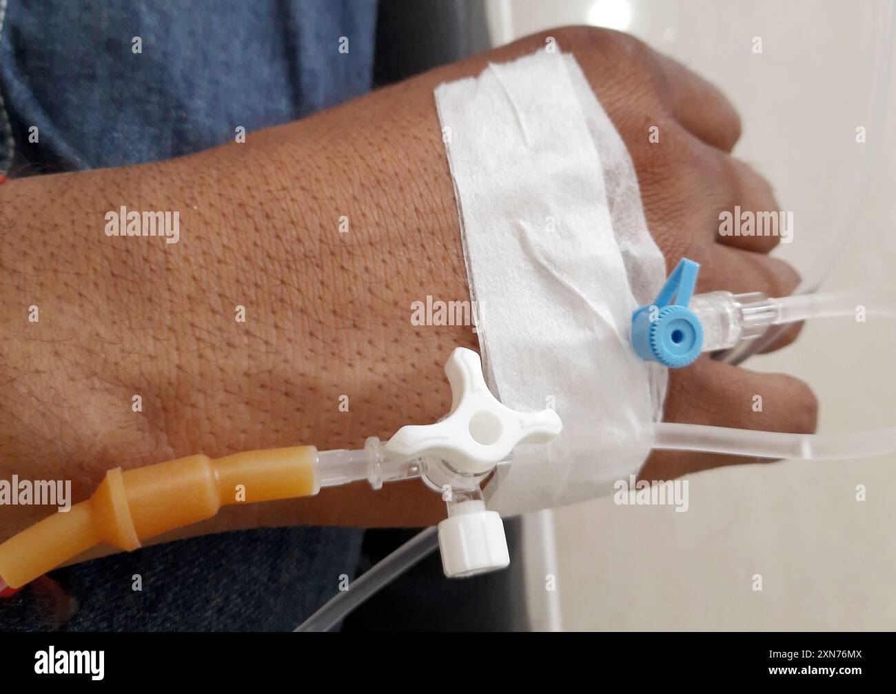 Männlicher Patient in Krankenhaustherapie, Venenkatheter in Armvene einführen Stockfoto