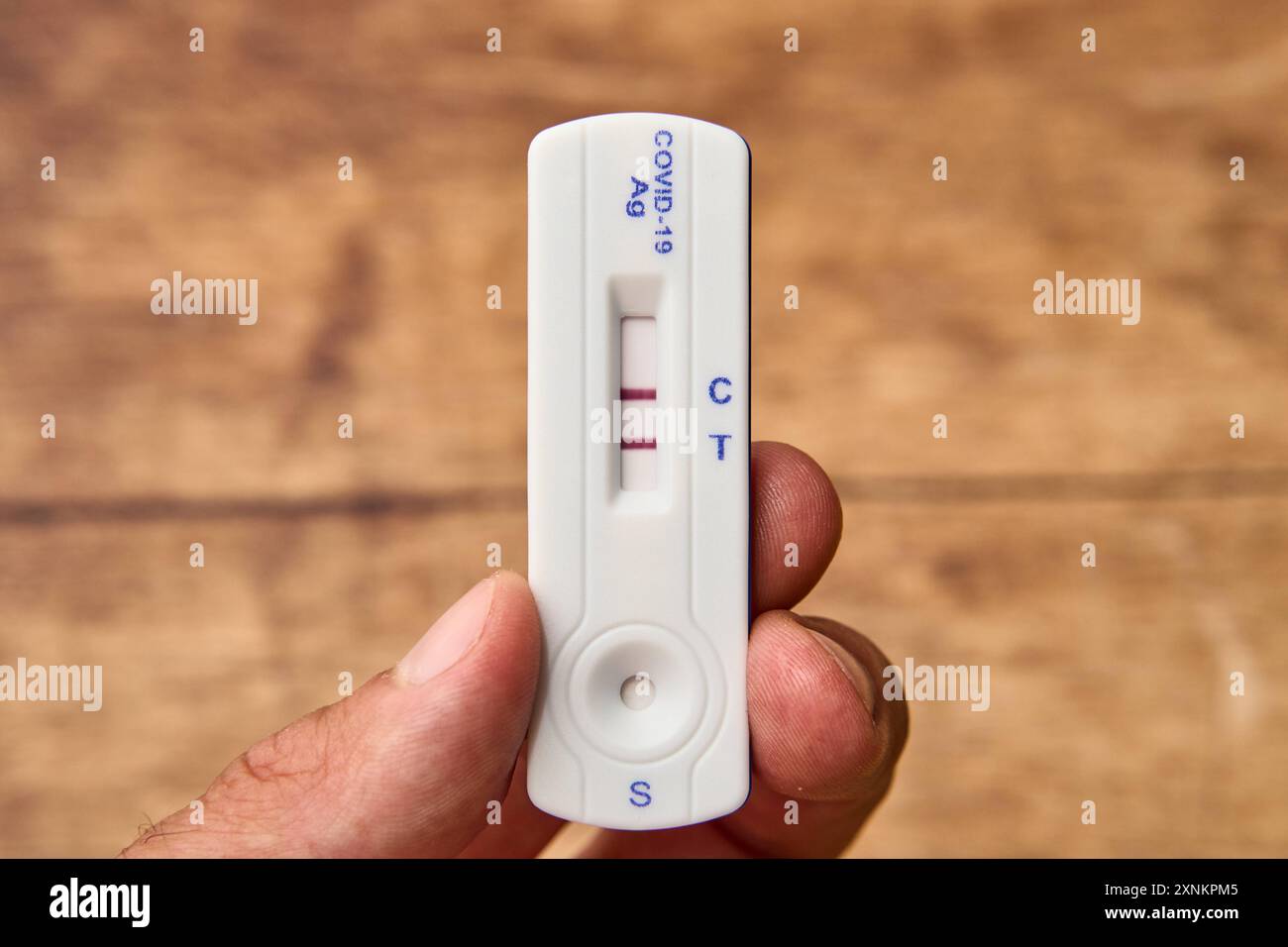 Augsburg, Bayern, Deutschland - 1. August 2024: Man wurde mit einem Schnelltest positiv auf COVID-19 getestet. Hand-halten-Coronavirus-Test. PHOTOMONTAGE *** Mann hat sich positiv auf COVID-19 mit einem Schnelltest getestet. Hand halten Coronavirus-Test. FOTOMONTAGE Stockfoto
