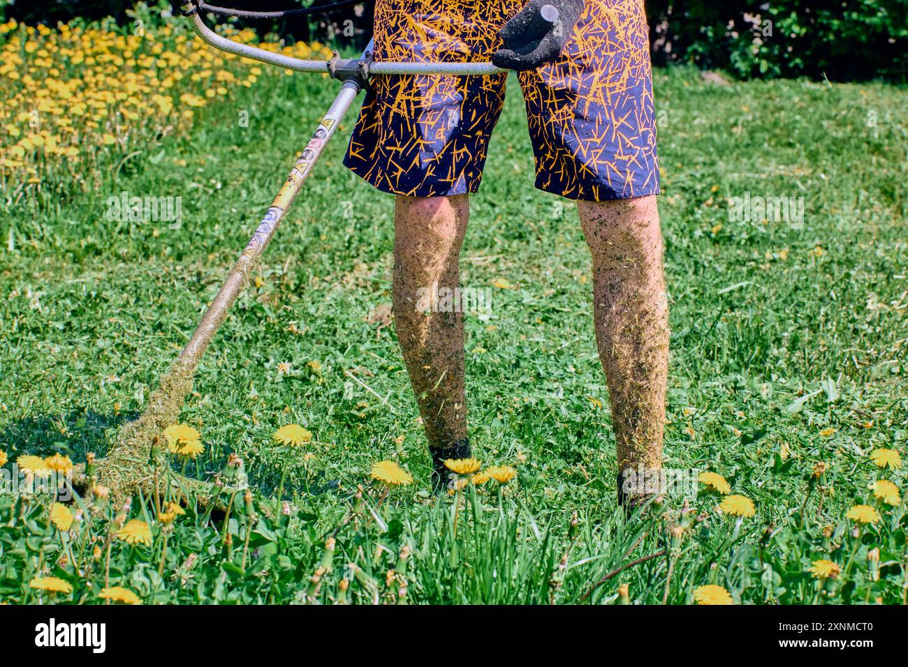 Die Haut der Beine von Landschaftsbauern, die nicht durch Schutzkleidung geschützt sind, ist mit Bruchstücken von zerdrücktem Unkraut bedeckt. Stockfoto