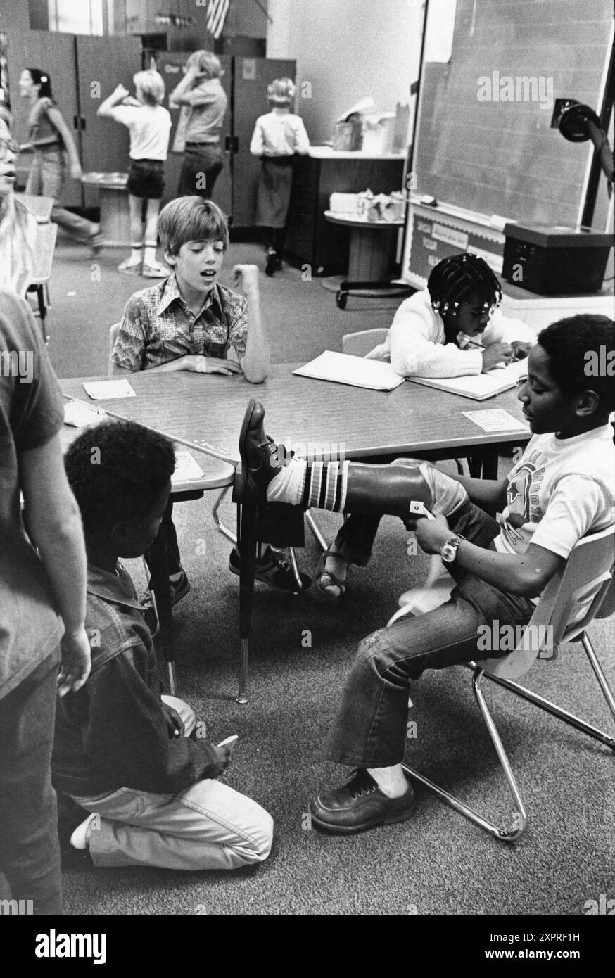 Austin Texas USA, 1984: Der schwarze Schüler Patrick Skeaton, der sein rechtes Bein aufgrund einer Spina bifida verlor, zeigt seine neue Beinprothese einem neugierigen Klassenkameraden. Teil einer erweiterten Fotofunktion. ©Bob Daemmrich Stockfoto
