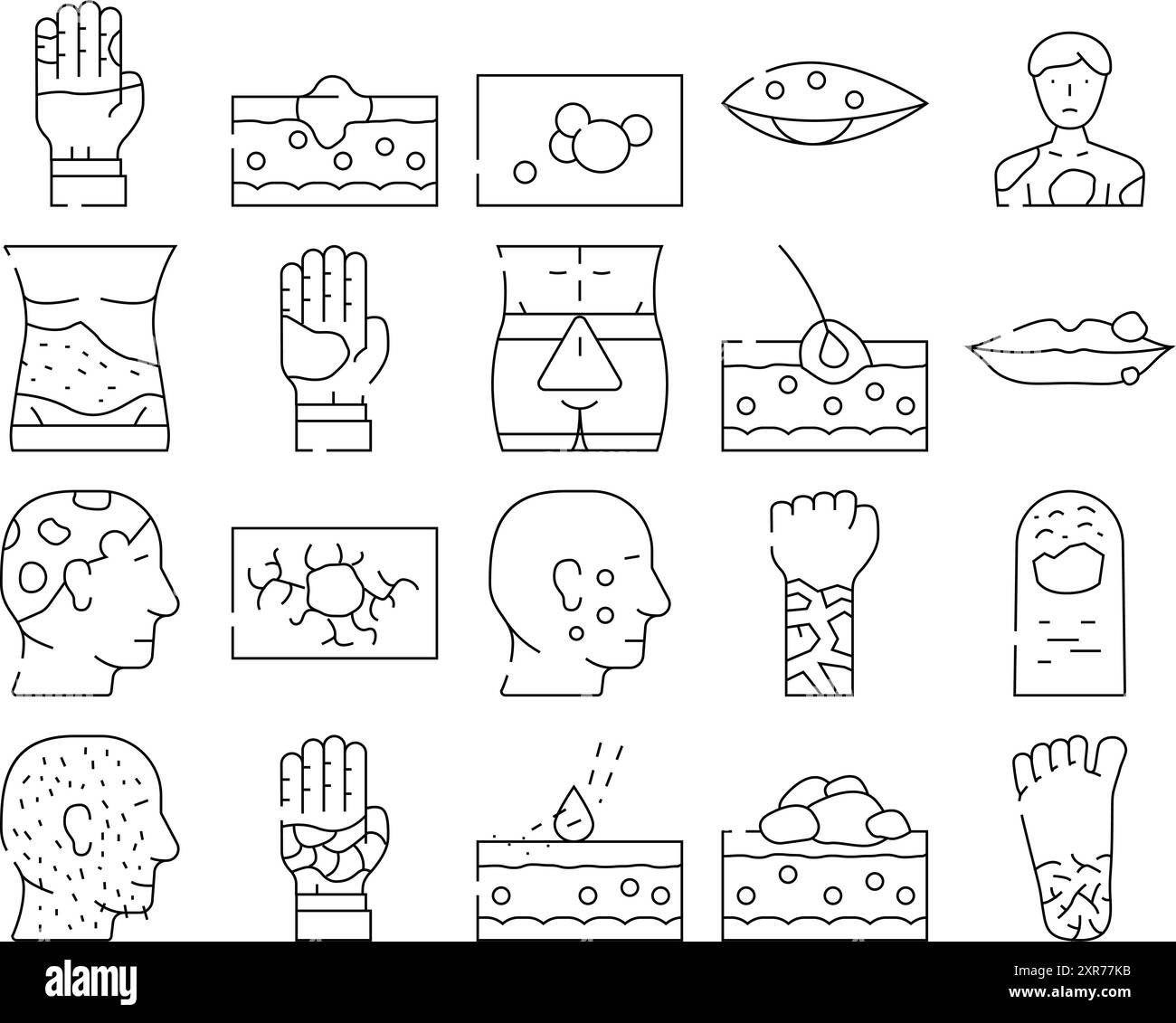 Hautkrankheit Menschliche Gesundheit Problem Symbole Set Vector Stock Vektor