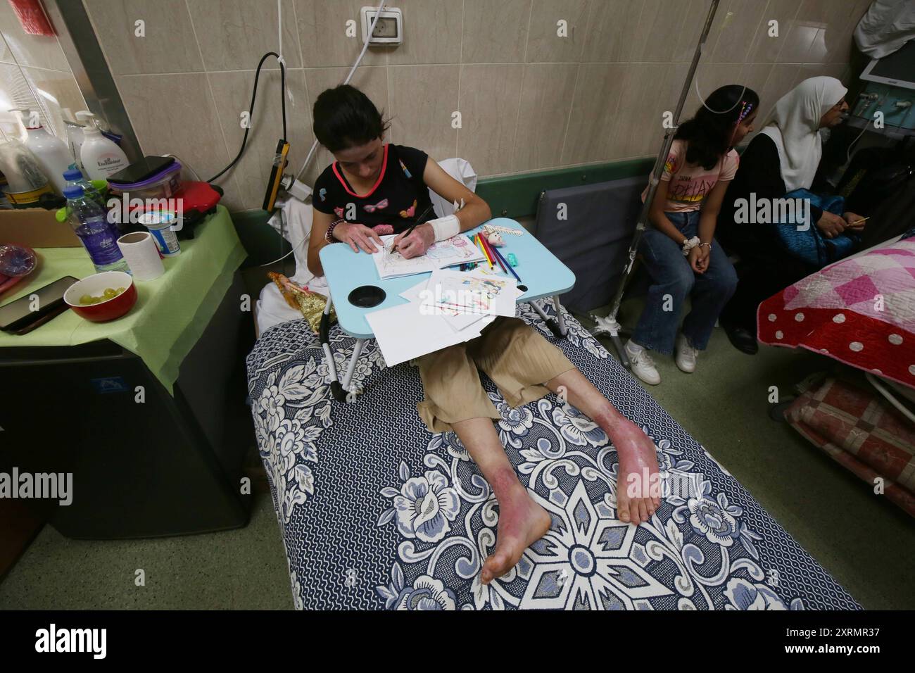 Die beiden palästinensischen Mädchen, Rima und Dina AQL, werden im Al-Aqsa Märtyrer Krankenhaus in Deir al-Balah im zentralen Gazastreifen behandelt. Die beiden palästinensischen Mädchen, Rima und Dina AQL, werden am 11. August 2024 im Al-Aqsa Märtyrerkrankenhaus in Deir al-Balah im zentralen Gazastreifen behandelt. Die Familie der beiden Mädchen wurde einem israelischen Angriff ausgesetzt, der dazu führte, dass alle acht Familienmitglieder Verbrennungen dritten Grades erlitten, 70 % bis 80 %. das Fehlen der notwendigen medizinischen Behandlung für die Verbrennungen führte zum allmählichen Tod von 6 Familienmitgliedern im Laufe von 10 Tagen, während die beiden Mädchen, Rima an Stockfoto
