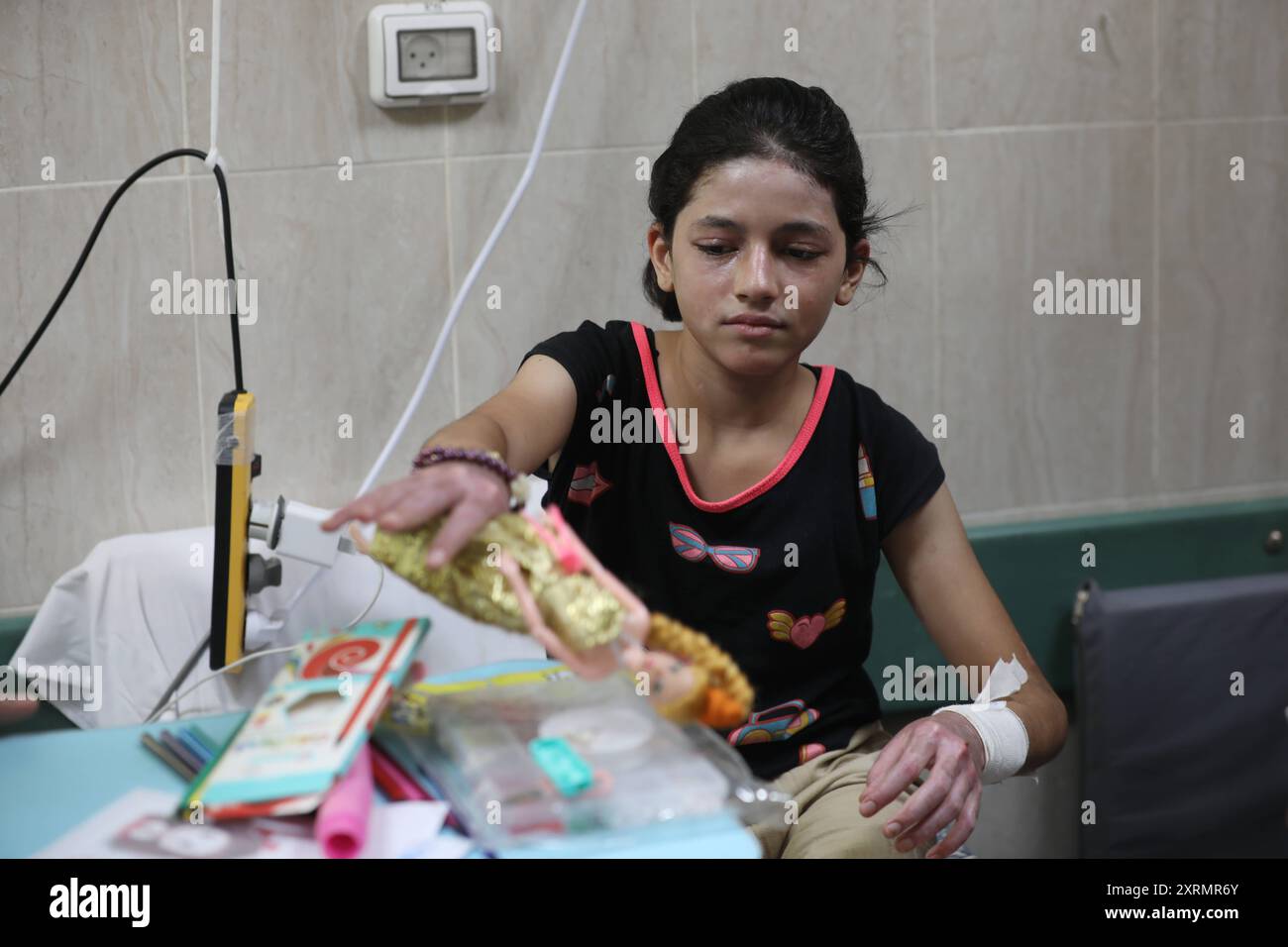 Die beiden palästinensischen Mädchen, Rima und Dina AQL, werden im Al-Aqsa Märtyrer Krankenhaus in Deir al-Balah im zentralen Gazastreifen behandelt. Die beiden palästinensischen Mädchen, Rima und Dina AQL, werden am 11. August 2024 im Al-Aqsa Märtyrerkrankenhaus in Deir al-Balah im zentralen Gazastreifen behandelt. Die Familie der beiden Mädchen wurde einem israelischen Angriff ausgesetzt, der dazu führte, dass alle acht Familienmitglieder Verbrennungen dritten Grades erlitten, 70 % bis 80 %. das Fehlen der notwendigen medizinischen Behandlung für die Verbrennungen führte zum allmählichen Tod von 6 Familienmitgliedern im Laufe von 10 Tagen, während die beiden Mädchen, Rima an Stockfoto