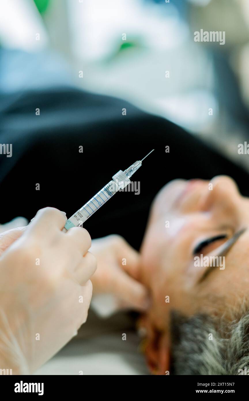 Eine Nahaufnahme zeigt einen behandelnden Arzt mit Handschuhen, der eine Spritze mit botox und Hyaluronsäure hält, die für die Injektion in das Gesicht eines Patienten vorbereitet ist Stockfoto