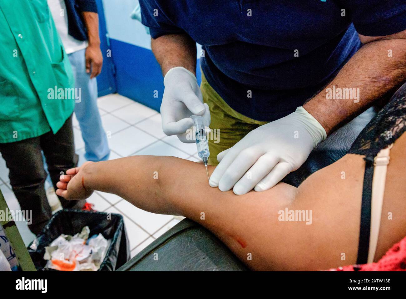 Entfernung von hormonellen Verhütungsmitteln, Lancetillo Gesundheitszentrum, La Parroquia, Quiche, Republik Guatemala, Zentralamerika Stockfoto