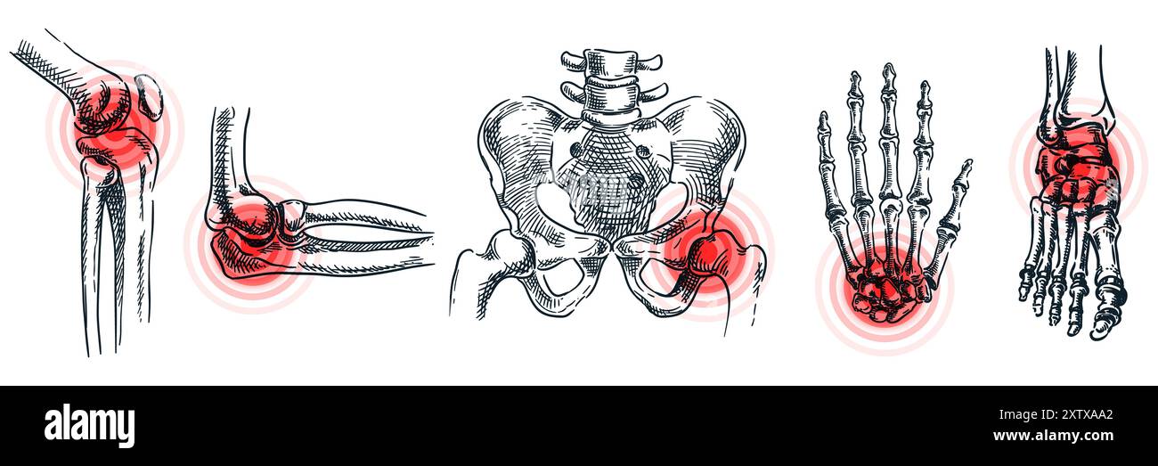 Gelenkarthritis, Osteoporose, Knochenerkrankungen und Entzündungen. Abstraktes Schmerzlokalisationssymbol. Abbildung der Vektorskizze. Handgezeichnete Kritzelanatomie Stock Vektor