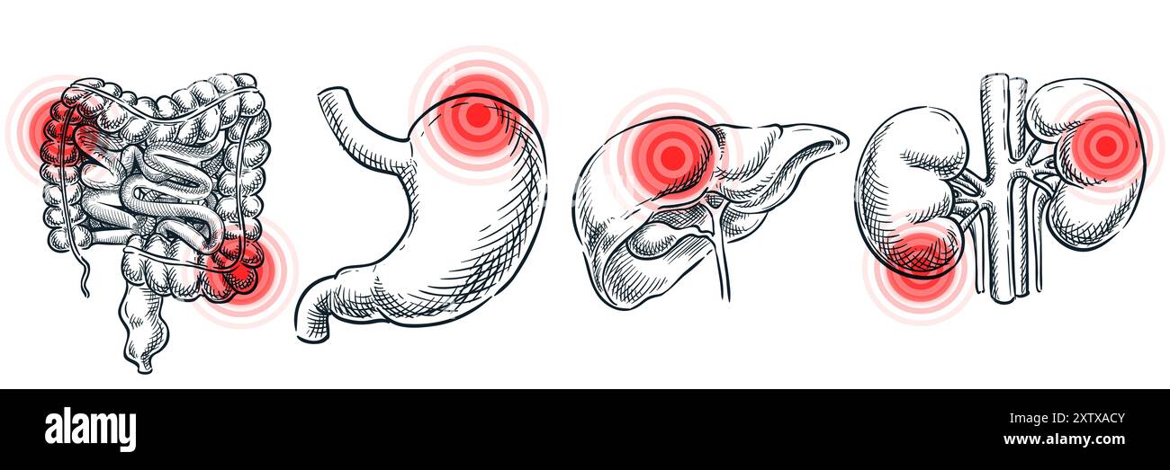 Innere Organerkrankungen, Krankheiten und Entzündungen. Abstraktes Schmerzlokalisationssymbol. Illustration medizinischer Vektorskizzen. Handgezeichnete Kritzelanatomie Stock Vektor