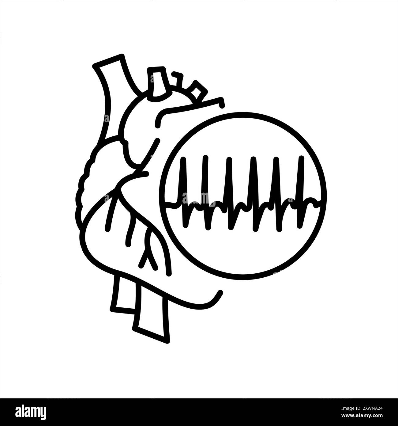 Schwarzes Symbol für Tachykardie-Linie. Signieren Sie für Webseite, mobile App, Schaltfläche, Logo. Schaltfläche Vektorisoliert. Bearbeitbare Kontur. Stock Vektor