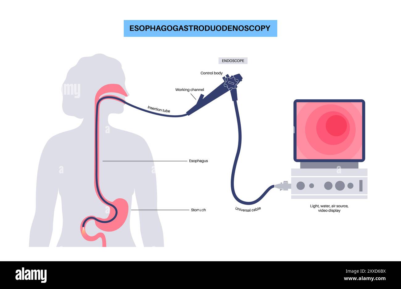 Oesophagogastroduodenoskopie, Illustration. Stockfoto