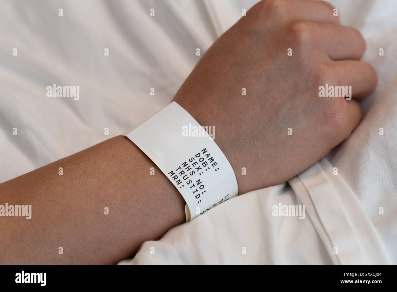 Arm einer jungen Frau, die ein Patientenarmband mit persönlichen Daten trägt, Basingstoke Hospital, Großbritannien. Konzept: Wartezeiten, Datenschutzverletzung, NHS, Gesundheitswesen Stockfoto