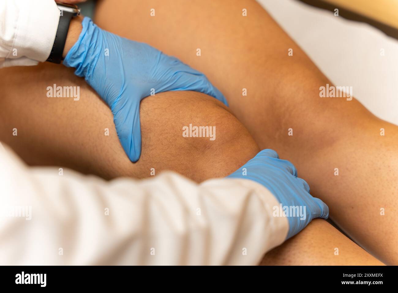 Knieverluxation und -Verletzung, Verstauchung, Muskel-Skelett-System Stockfoto