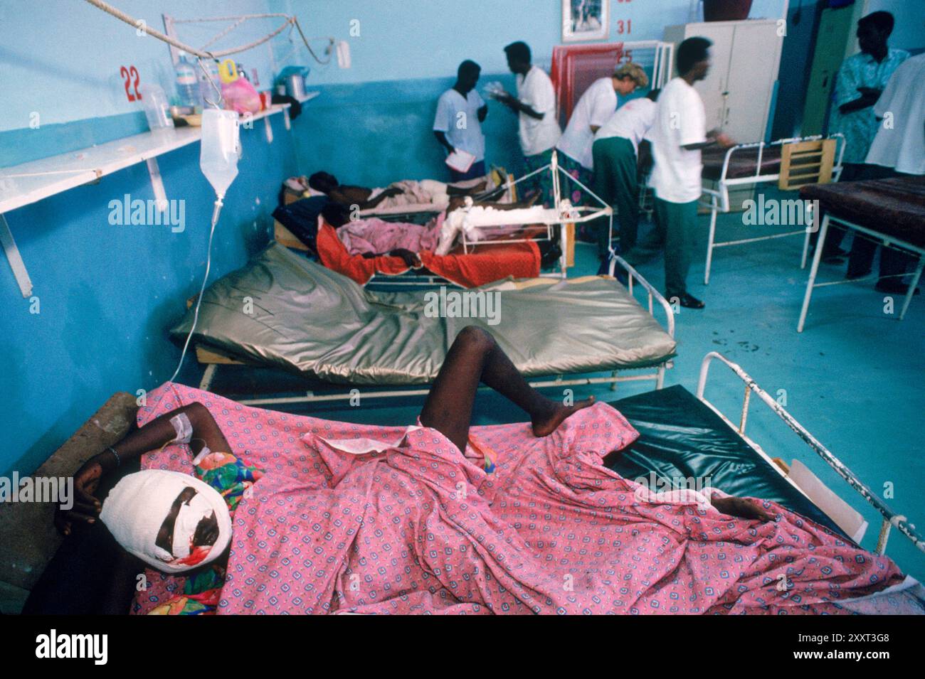 Opfer des Bürgerkriegs in einem Krankenhaus in Mogadischu, Somalia. Stockfoto