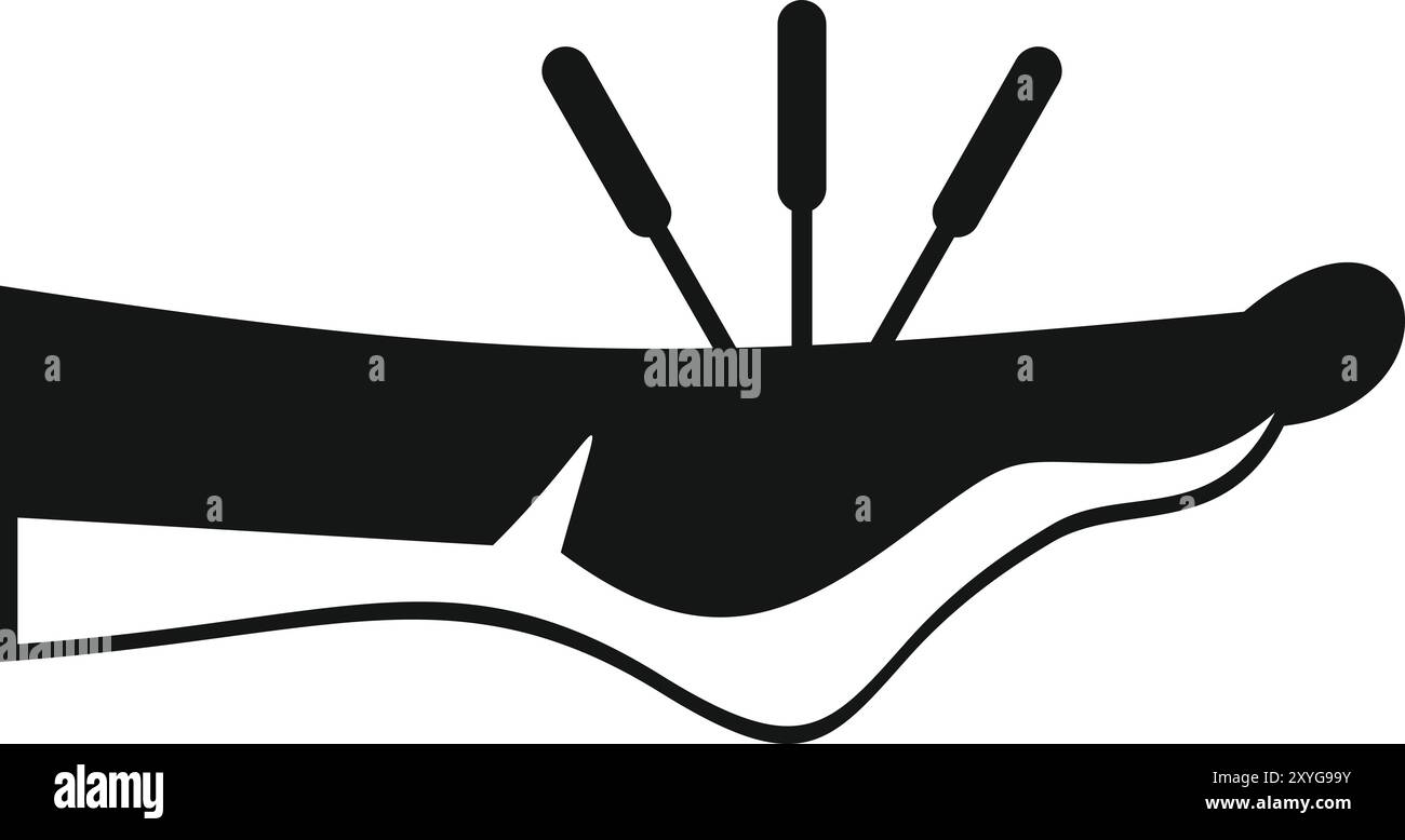 Akupunkteur, der Nadeln für die Therapie auf den Fuß legt und bestimmte Akupunkturpunkte zur Schmerzlinderung und Heilung stimuliert Stock Vektor