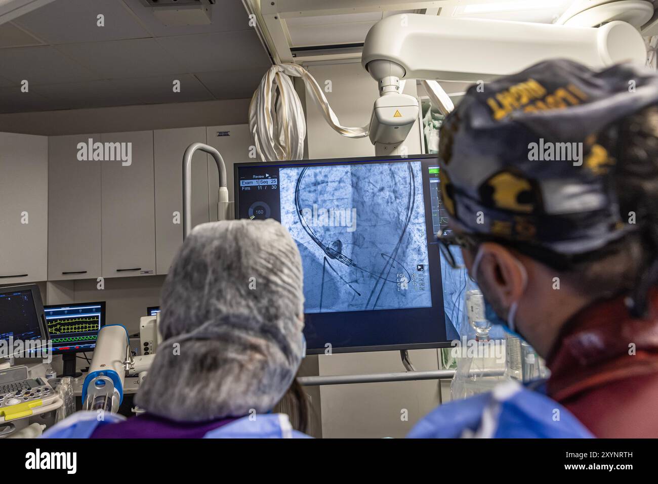 Istanbul, Türkei 29. Februar 2024; Röntgen für Klappenersatz mit Melodiebahn. Sicht auf prothetische Herzklappendysfunktion bei Patienten mit MI Stockfoto