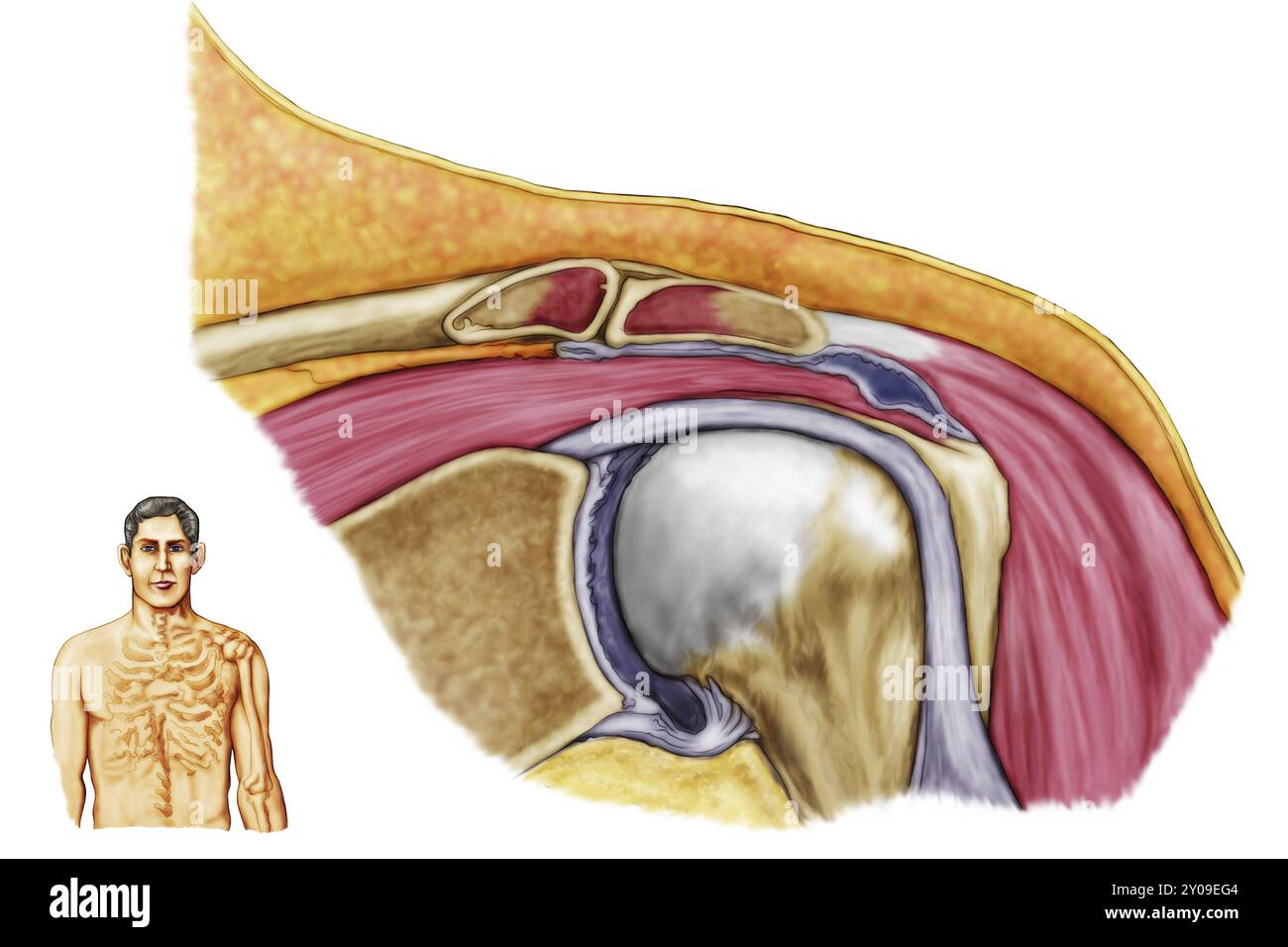 Anatomie der linken Schulter, koronale Ansicht Stockfoto