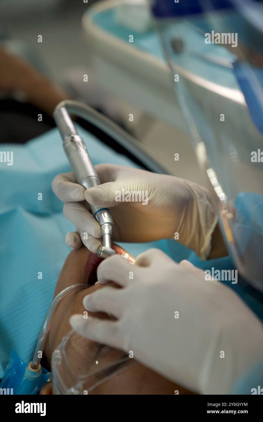 Der Zahnarzt, der auf dem Foto nicht zu sehen ist, betreut einen Patienten und spiegelt eine realistische und professionelle Umgebung wider Stockfoto