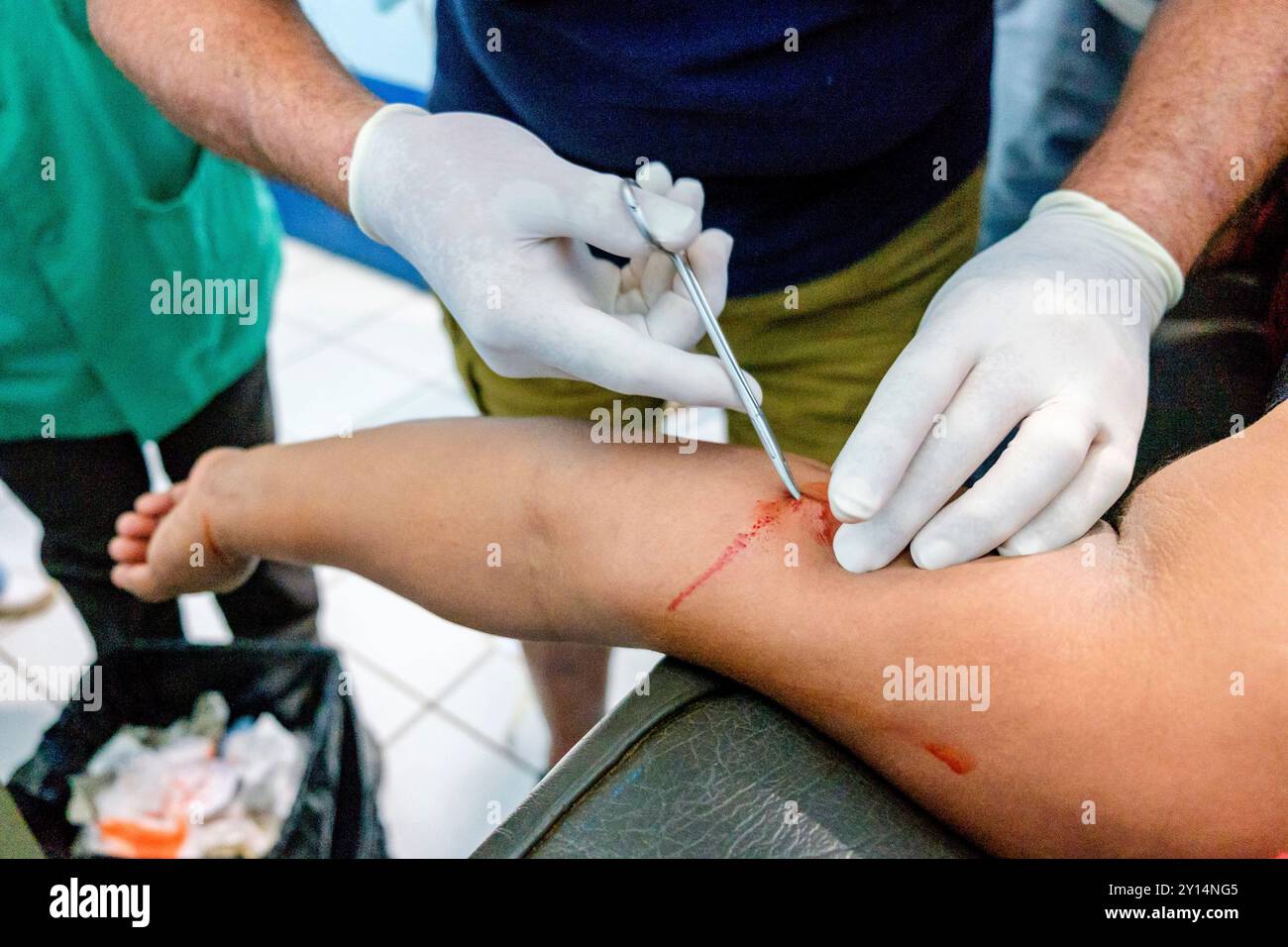 Entfernung von hormonellen Verhütungsmitteln, Lancetillo Gesundheitszentrum, La Parroquia, Quiche, Republik Guatemala, Zentralamerika. Stockfoto