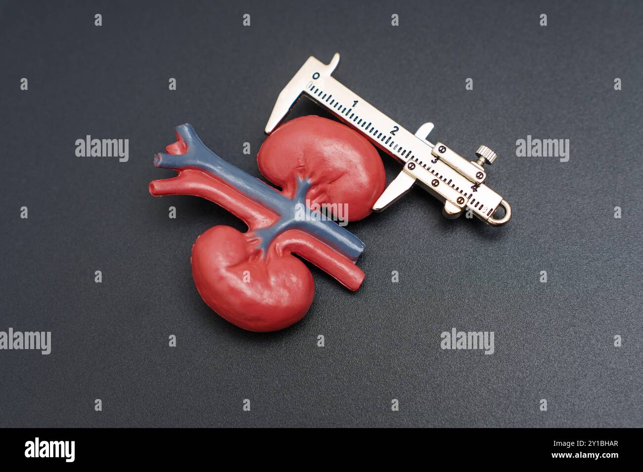 Nierenmodell mit Gefäßstrukturen und Messschieber auf schwarzem Hintergrund, das anatomische Merkmale und Messtechniken in ME hervorhebt Stockfoto