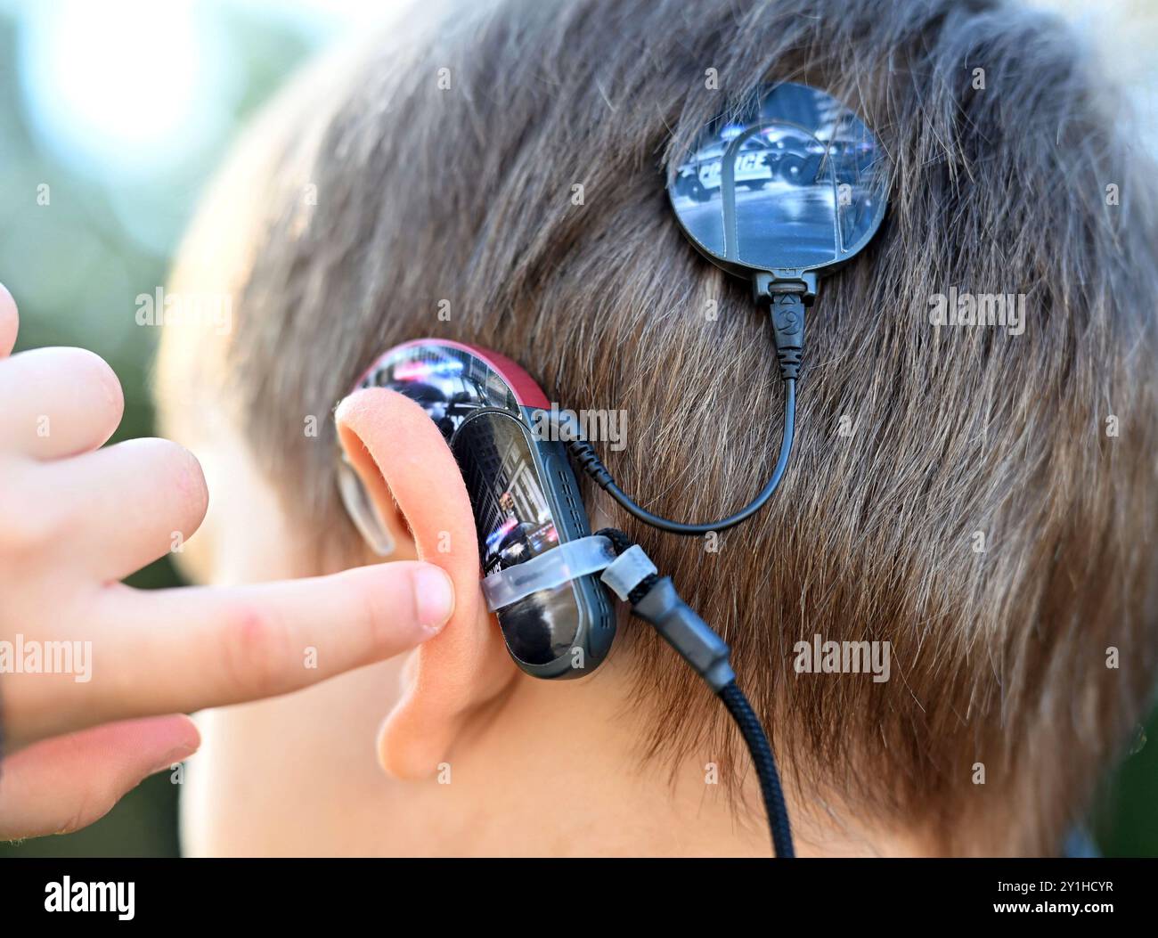 Karlsruhe, Deutschland. September 2024. Ein Cochlea-Implantat, eine Hörprothese, wird auf der Rückseite des Kopfes eines siebenjährigen Jungen befestigt, um schwerhörigen und Tauben das Hören zu ermöglichen. Die Technologie beinhaltet die elektrische Stimulation der Nervenzellen des Hörnervs. Dazu wird ein Elektrodenarray in die Cochlea eingeführt. Der äußere Teil besteht aus einem Mikrofon und einem Prozessor, der die Toninformationen in elektrische Impulse umwandelt. Quelle: Uli Deck/dpa/Alamy Live News Stockfoto