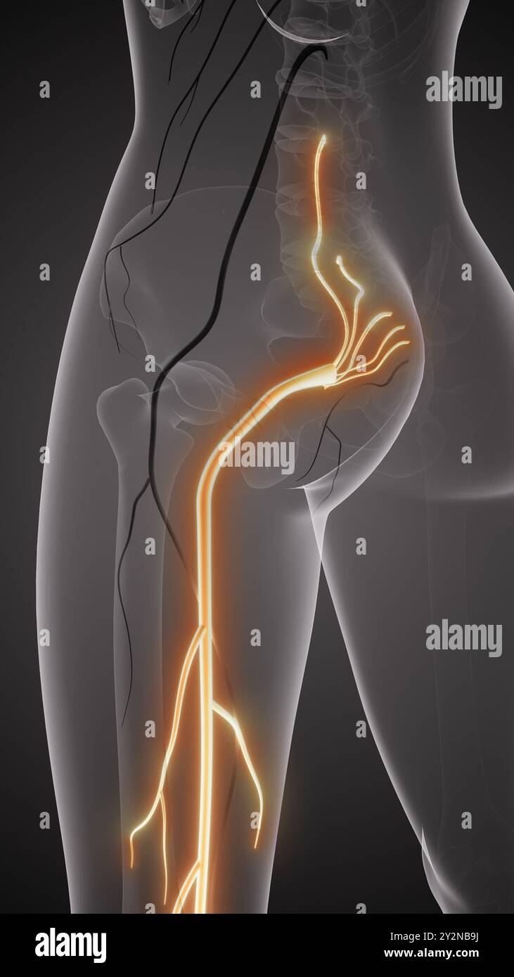 Ischiasnervenschmerz im unteren Rückenbereich Stockfoto