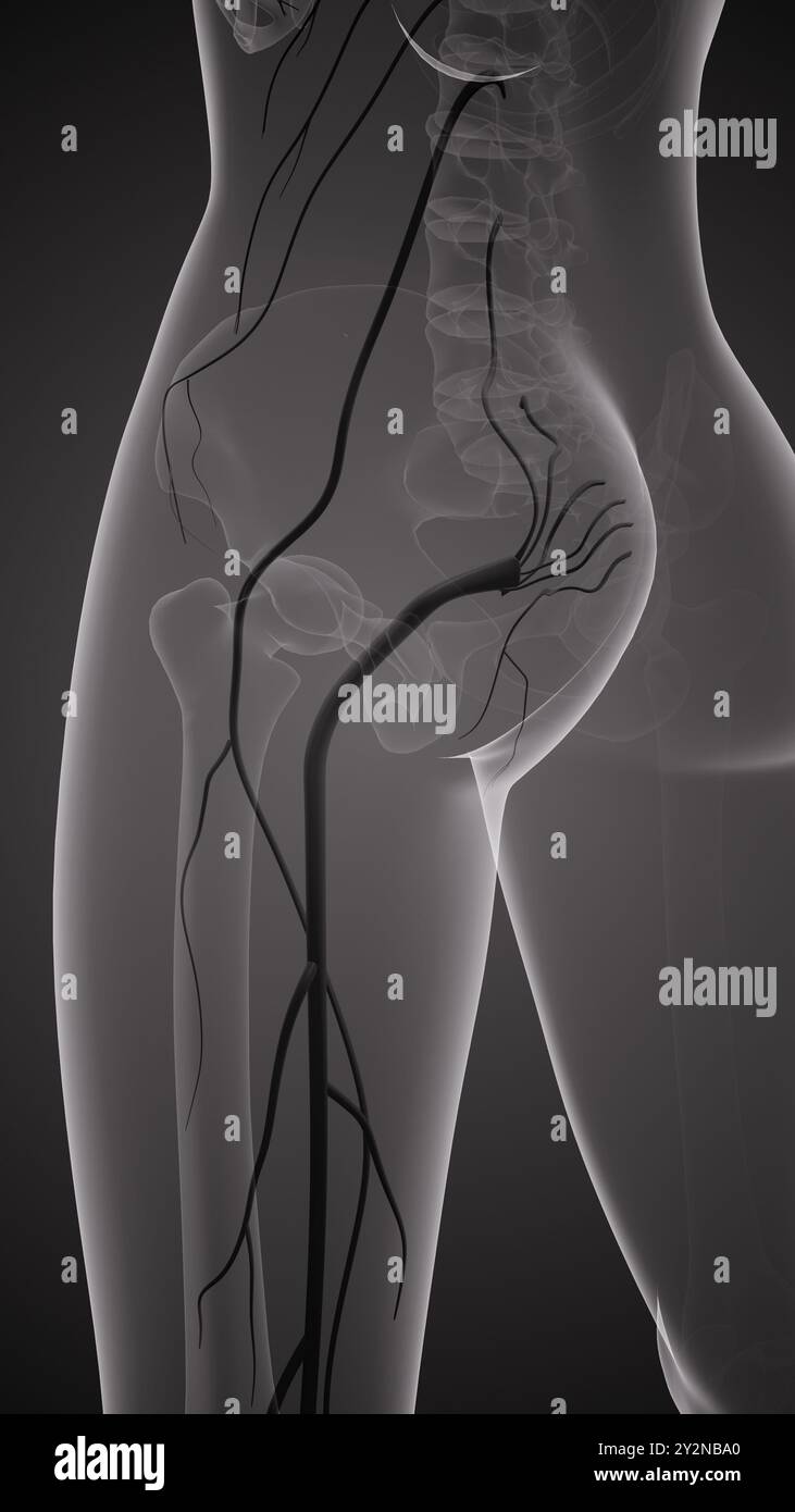 Ischiasnervenschmerz im unteren Rückenbereich Stockfoto