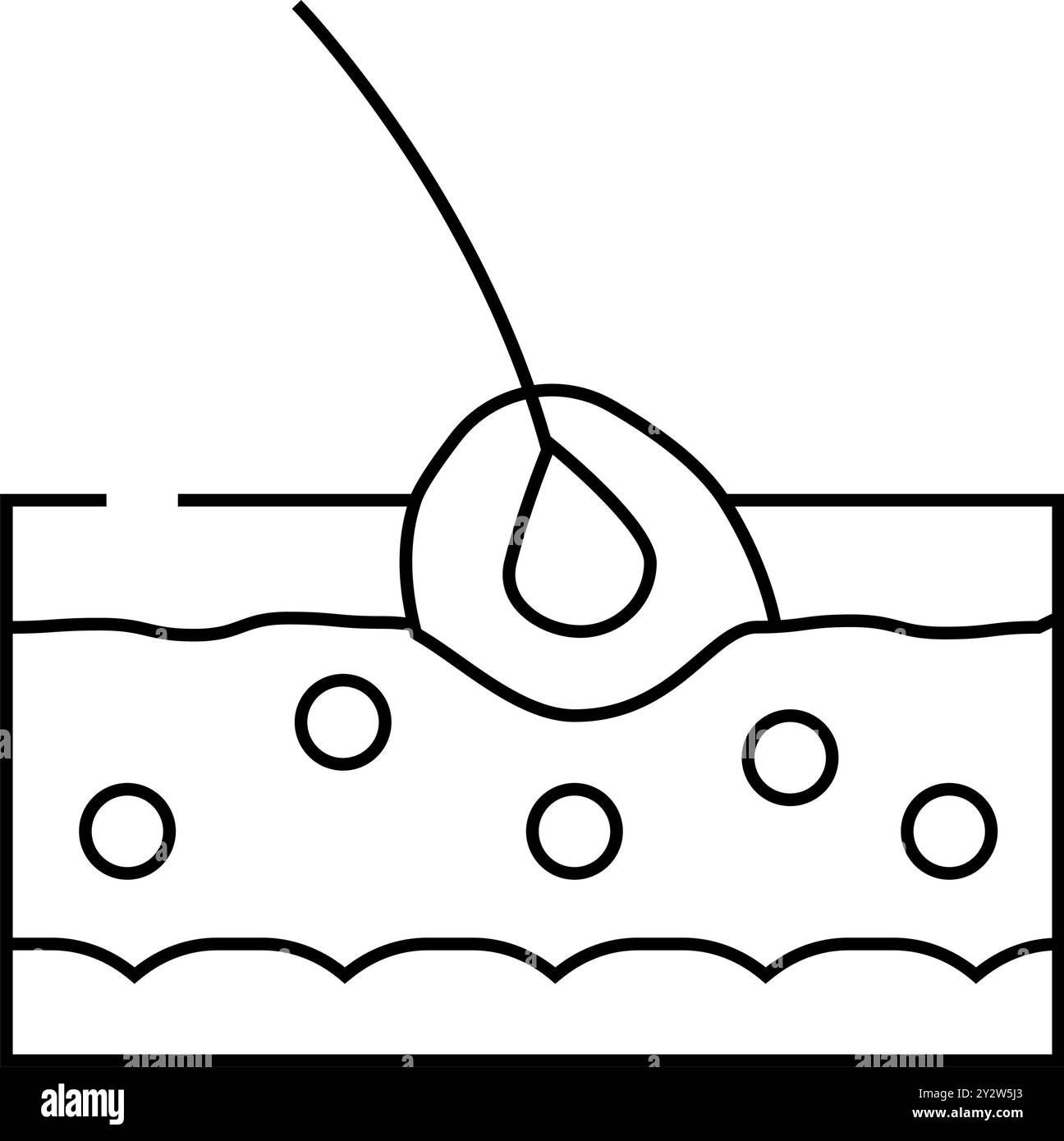 Follikulitis Hauterkrankung Problem Linie Symbol Vektor Illustration Stock Vektor