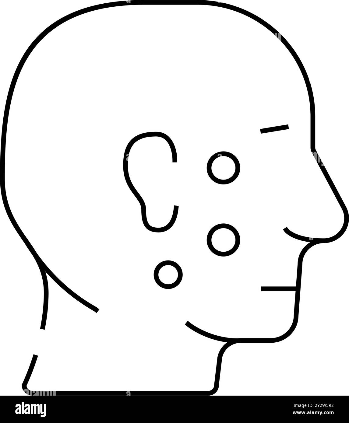 Akne Gesichtshaut Krankheit Linie Symbol Vektor Illustration Stock Vektor