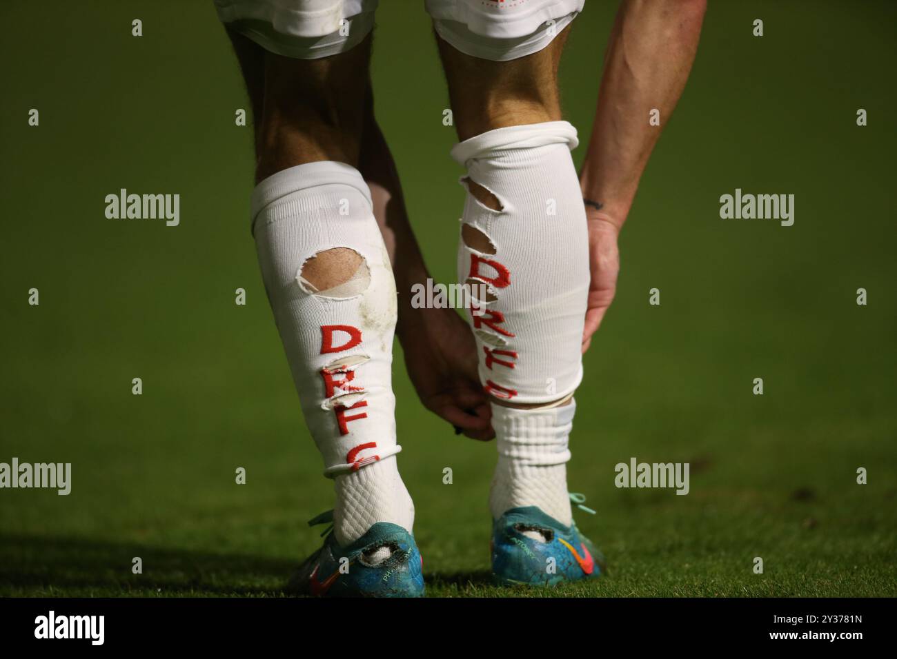 Löcher werden in die Socken von Jamie Sterry der Doncaster Rovers während des Spiels der Sky Bet League 2 zwischen Harrogate Town und Doncaster Rovers in der Wetherby Road, Harrogate, am Donnerstag, den 12. September 2024 geschnitten. (Foto: Michael Driver | MI News) Credit: MI News & Sport /Alamy Live News Stockfoto