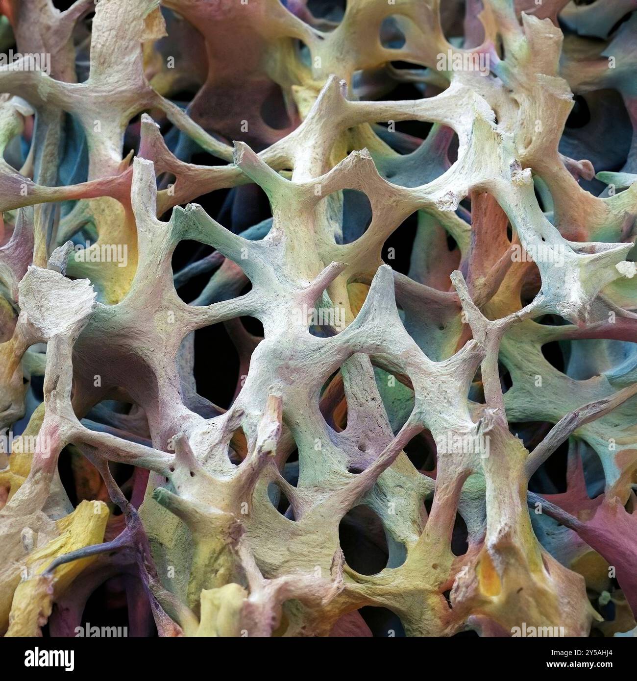 Knochengewebe. Farbige Rasterelektronenmikrographie (REM) des kanzerösen (schwammigen) Knochens. Knochengewebe kann kortikal (kompakt) oder kanzerös sein. Kortikalknochen bilden in der Regel die Außenseite des Knochens, während sich im Inneren der Knochenknochen befinden. Der Knochenknochen zeichnet sich durch eine Wabenanordnung aus, die ein Netz von Trabekeln (stabförmiges Gewebe) umfasst. Diese Strukturen unterstützen und stärken den Knochen. Die Räume innerhalb dieses Gewebes enthalten Knochenmark (nicht sichtbar), eine blutbildende Substanz. Vergrößerung: 35 x bei Druck von 10 cm Breite. Stockfoto