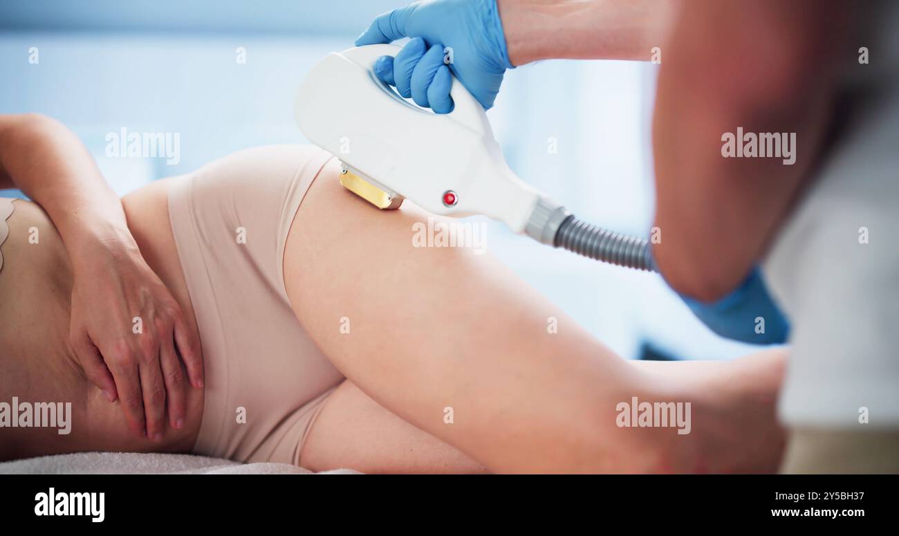 Close-up liegende Frau, die Epilation Laser Behandlung am Gesäß Stockfoto