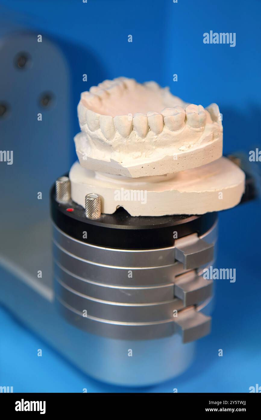 Keramische Zahnkronen für Implantate. Herstellung von Zahnkronen und Zahnersatz aus Keramik. Scannen von Gipsabdrücken von Zähnen. Stockfoto