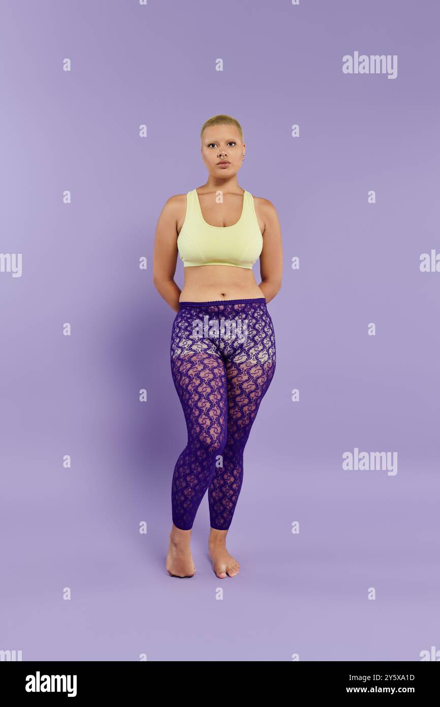 Eine junge kahlköpfige Frau steht selbstbewusst und trägt farbenfrohe Kleidung, die die Aufmerksamkeit fesselt. Stockfoto