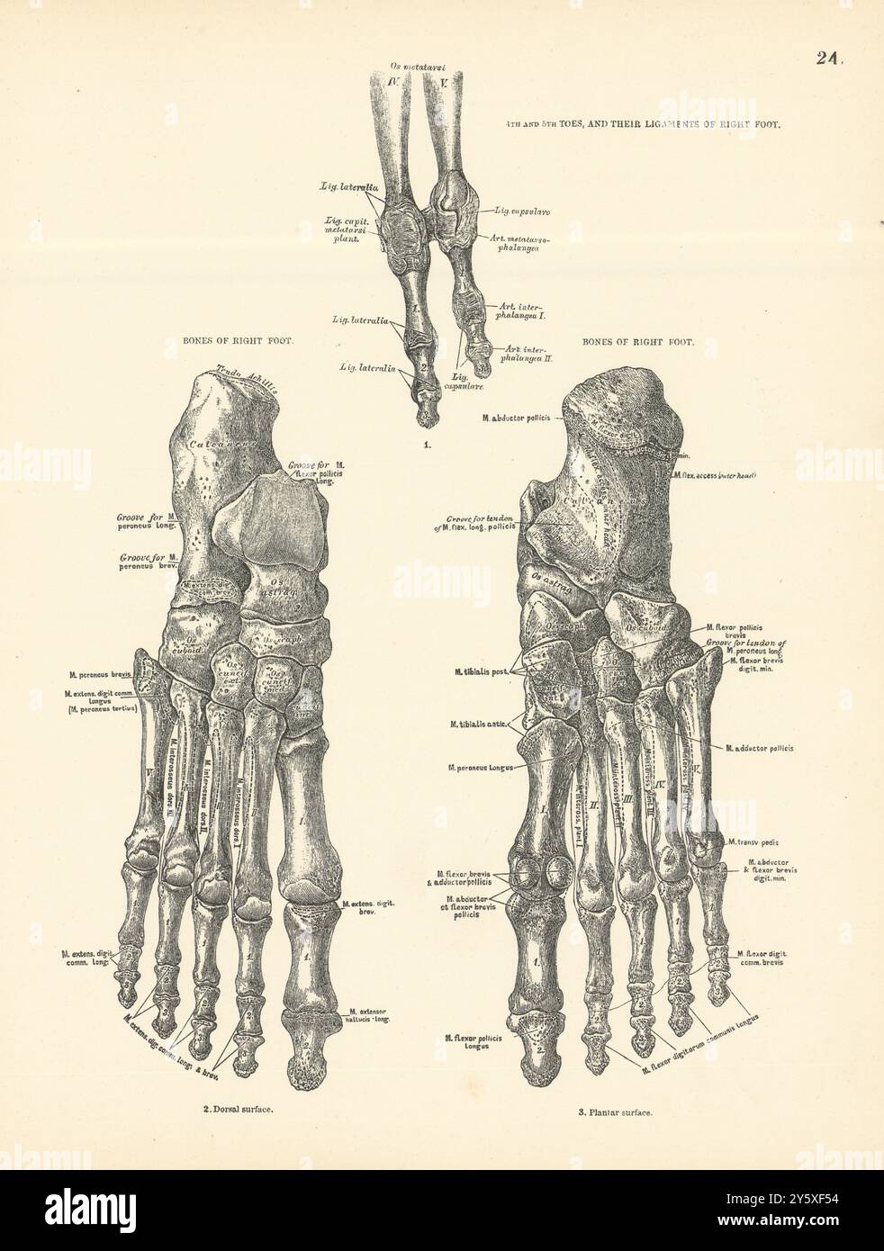 Anatomie. Rechter Fußknochen, 4. Und 5. Zehen, Bänder 1880 alte antike Drucke Stockfoto