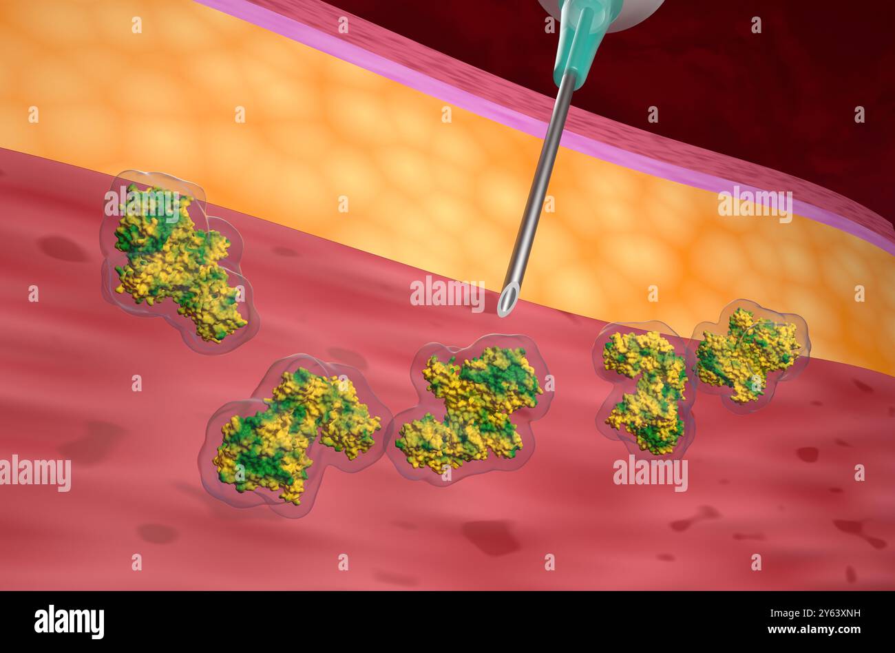 Botulinum Neurotoxin Inject - 3D Illustration Nahaufnahme Stockfoto