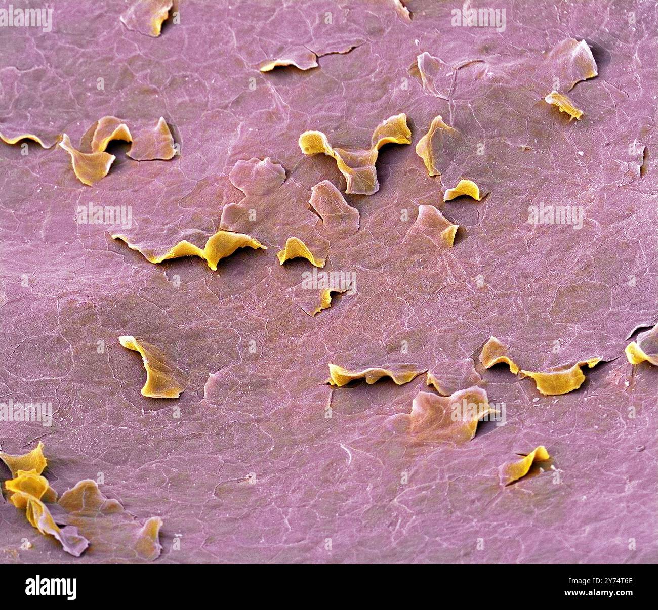Hartes Gaumenfutter. Farbige Rasterelektronenmikroskopie (REM), die die Zellen des Plattenepithels zeigt, die die Schleimhaut des harten Gaumens bedecken. Der harte Gaumen ist eine dünne horizontale knöcherne Platte des Schädels, die sich im Dach des Mundes befindet. Hier scheiden einige der Zellen aus (Abschuppung). Vergrößerung: x200, wenn 10 Zentimeter breit gedruckt. Stockfoto