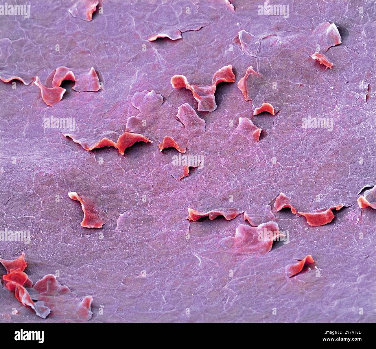 Hartes Gaumenfutter. Farbige Rasterelektronenmikroskopie (REM), die die Zellen des Plattenepithels zeigt, die die Schleimhaut des harten Gaumens bedecken. Der harte Gaumen ist eine dünne horizontale knöcherne Platte des Schädels, die sich im Dach des Mundes befindet. Hier scheiden einige der Zellen aus (Abschuppung). Vergrößerung: x200, wenn 10 Zentimeter breit gedruckt. Stockfoto