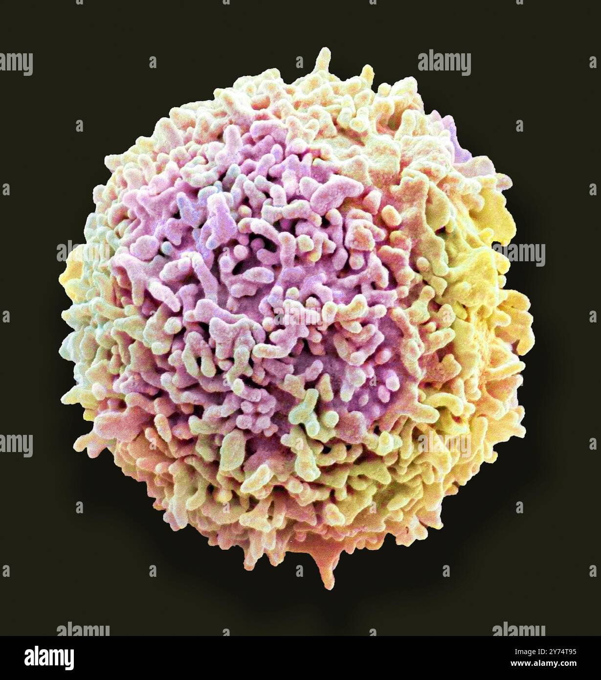 Ruhe-T-Lymphozyten. Farbige Rasterelektronenmikrographie (REM) eines ruhenden T-Lymphozyten aus einer menschlichen Blutprobe. T-Lymphozyten oder T-Zellen sind eine Art weißer Blutkörperchen und Bestandteile des körpereigenen Immunsystems. Sie Reifen im Thymus. T-Lymphozyten erkennen eine bestimmte Stelle auf der Oberfläche von Krankheitserregern oder Fremdkörpern (Antigene), binden sich daran und ziehen Antikörper oder Zellen an, um dieses Antigen zu eliminieren. Exemplar mit freundlicher Genehmigung von Professor Greg Towers, University College London. Vergrößerung: x13000 bei Druck in 10 Zentimetern Breite Stockfoto