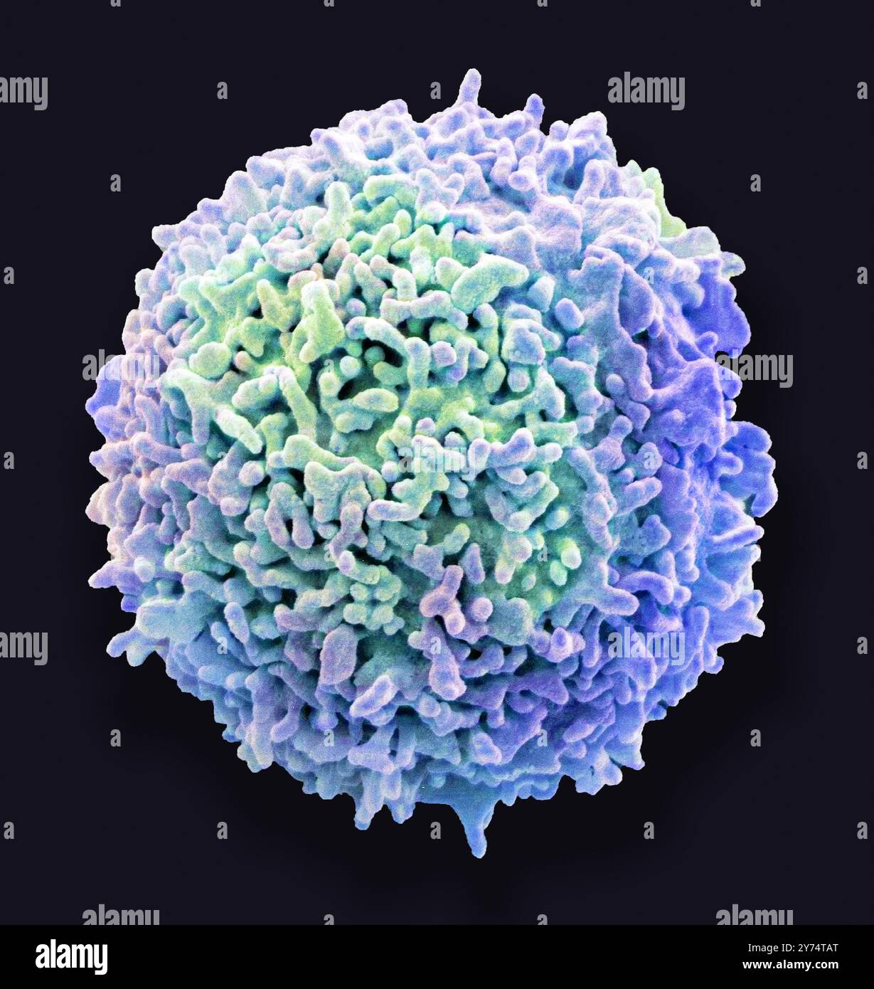 Ruhe-T-Lymphozyten. Farbige Rasterelektronenmikrographie (REM) eines ruhenden T-Lymphozyten aus einer menschlichen Blutprobe. T-Lymphozyten oder T-Zellen sind eine Art weißer Blutkörperchen und Bestandteile des körpereigenen Immunsystems. Sie Reifen im Thymus. T-Lymphozyten erkennen eine bestimmte Stelle auf der Oberfläche von Krankheitserregern oder Fremdkörpern (Antigene), binden sich daran und ziehen Antikörper oder Zellen an, um dieses Antigen zu eliminieren. Exemplar mit freundlicher Genehmigung von Professor Greg Towers, University College London. Vergrößerung: x13000 bei Druck in 10 Zentimetern Breite Stockfoto