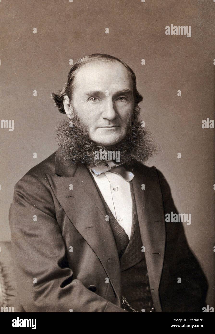 Alexander Russell Simpson Sir Alexander Russell Simpson FRCPE FRSE LLD (1835–1916) war ein schottischer Arzt und Professor für Hebammen an der Universität Edinburgh. Er erfand die Achsenzugzange, auch bekannt als die Geburtshilfe-Zange, die bei der Geburt half und Schmerzen linderte Stockfoto