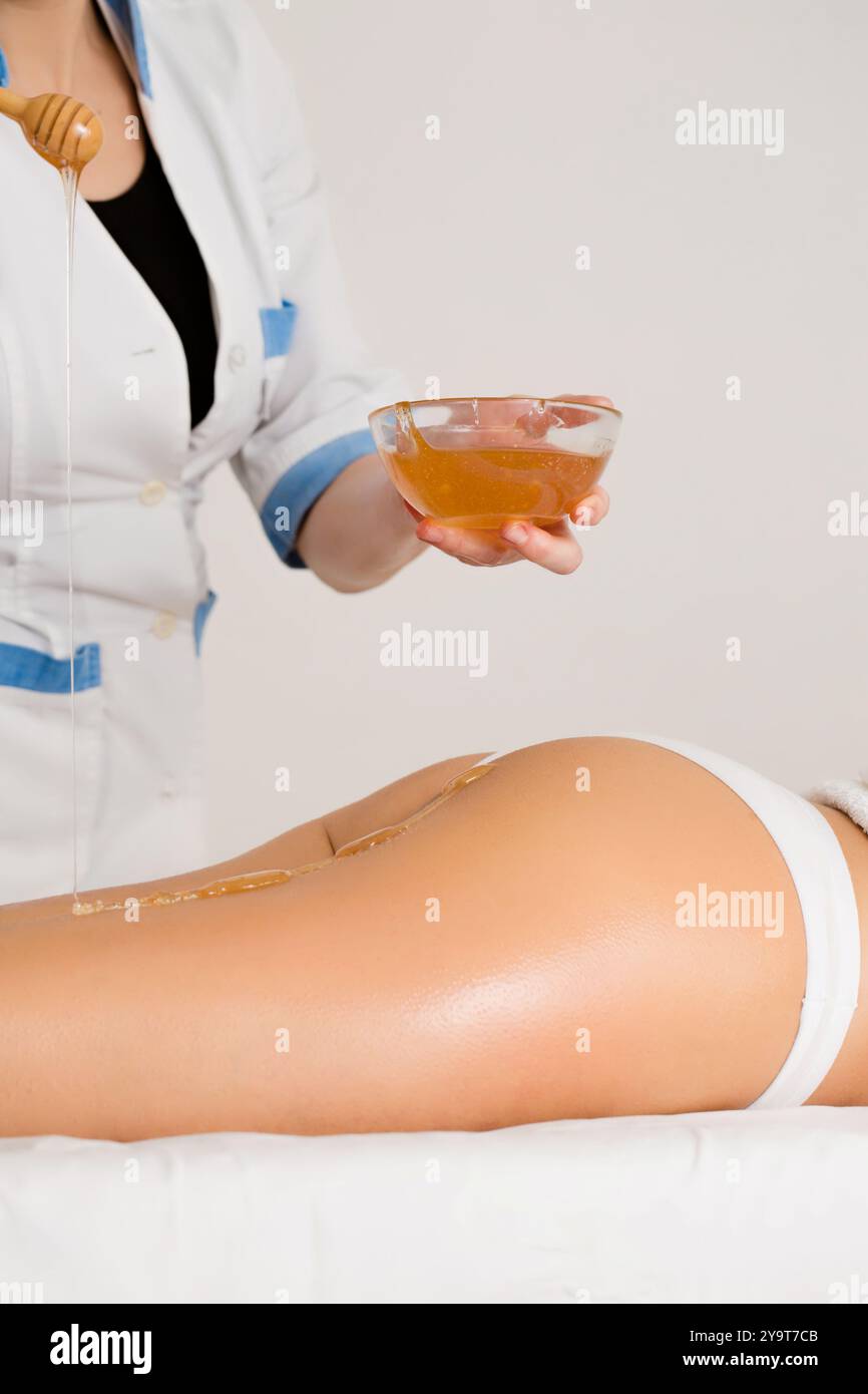 Die Masseurin gibt Honig auf die Beine des Patienten für eine Anti-Cellulite-Massage. Körperpflegekonzept Stockfoto