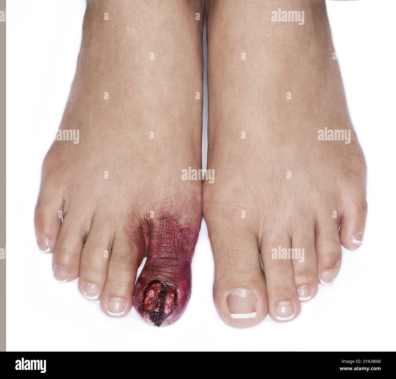 Spezielle Effekte der weiblichen Zehenpartie sorgen für Details Stockfoto